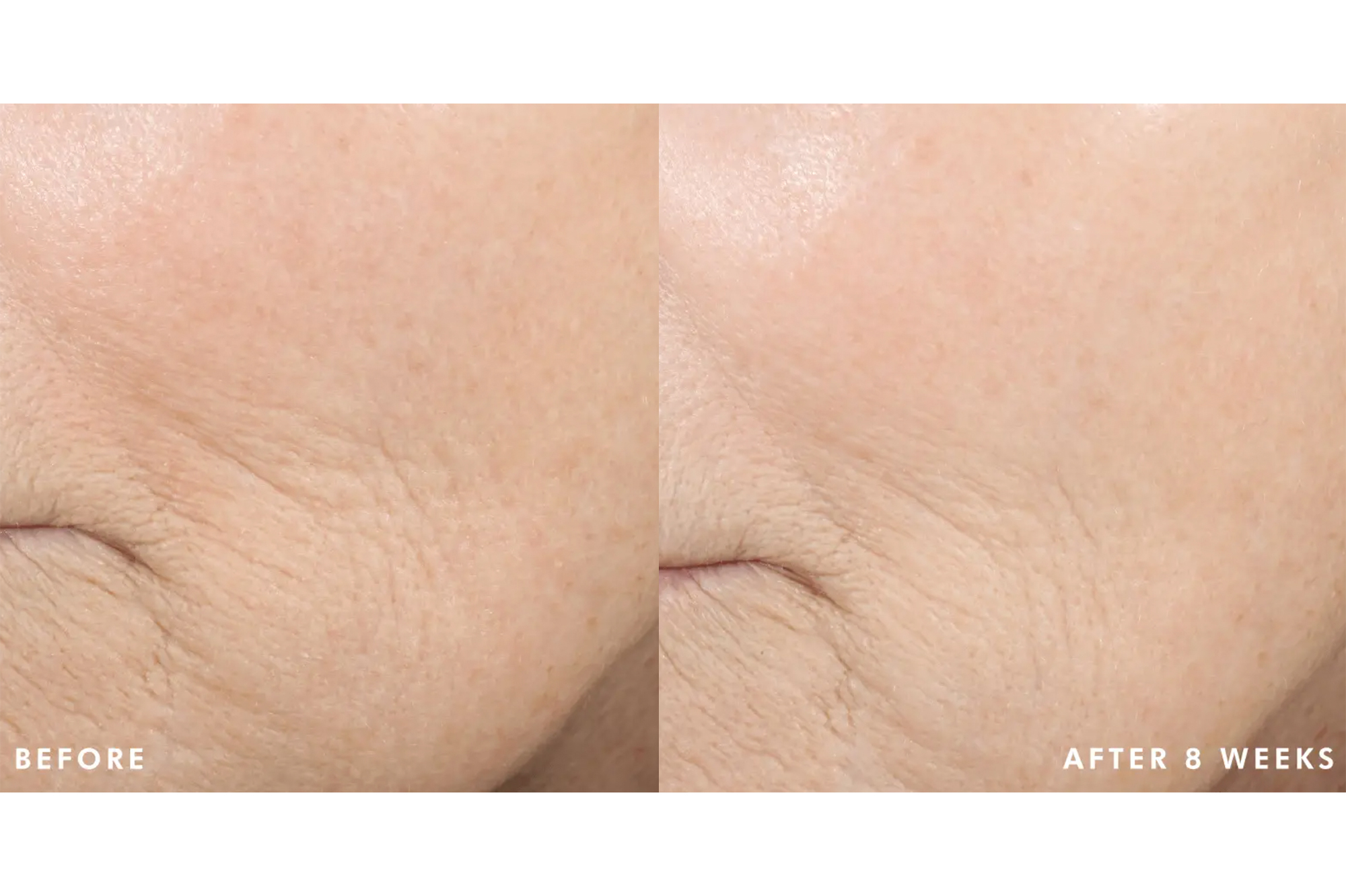 SkinCeuticals Triple Lipid Restore 242