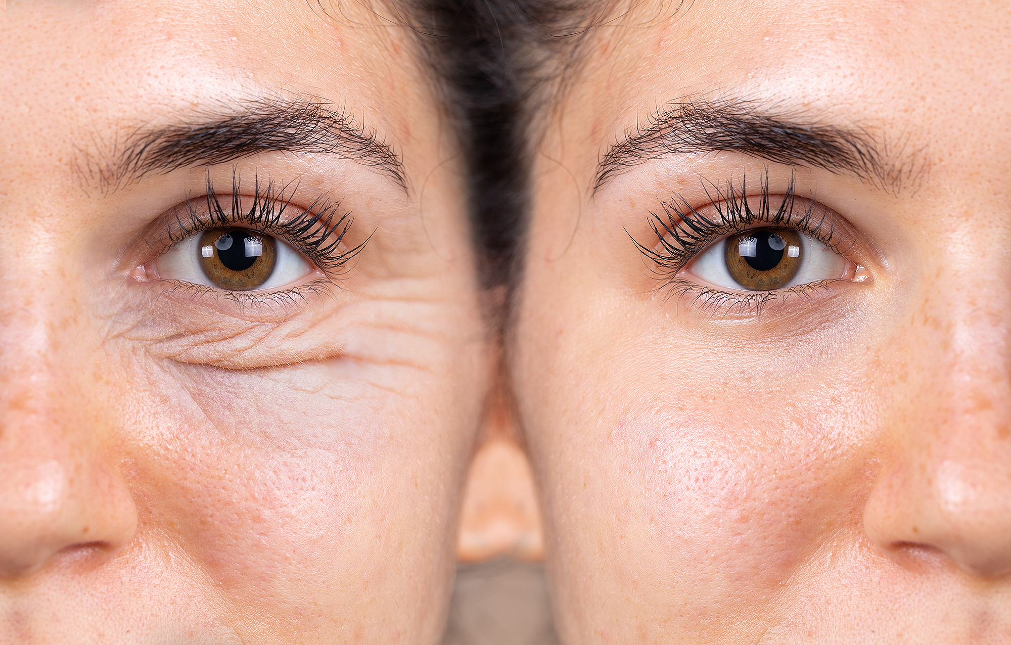 before-after-anti-aging-wrinkle-eye-cream