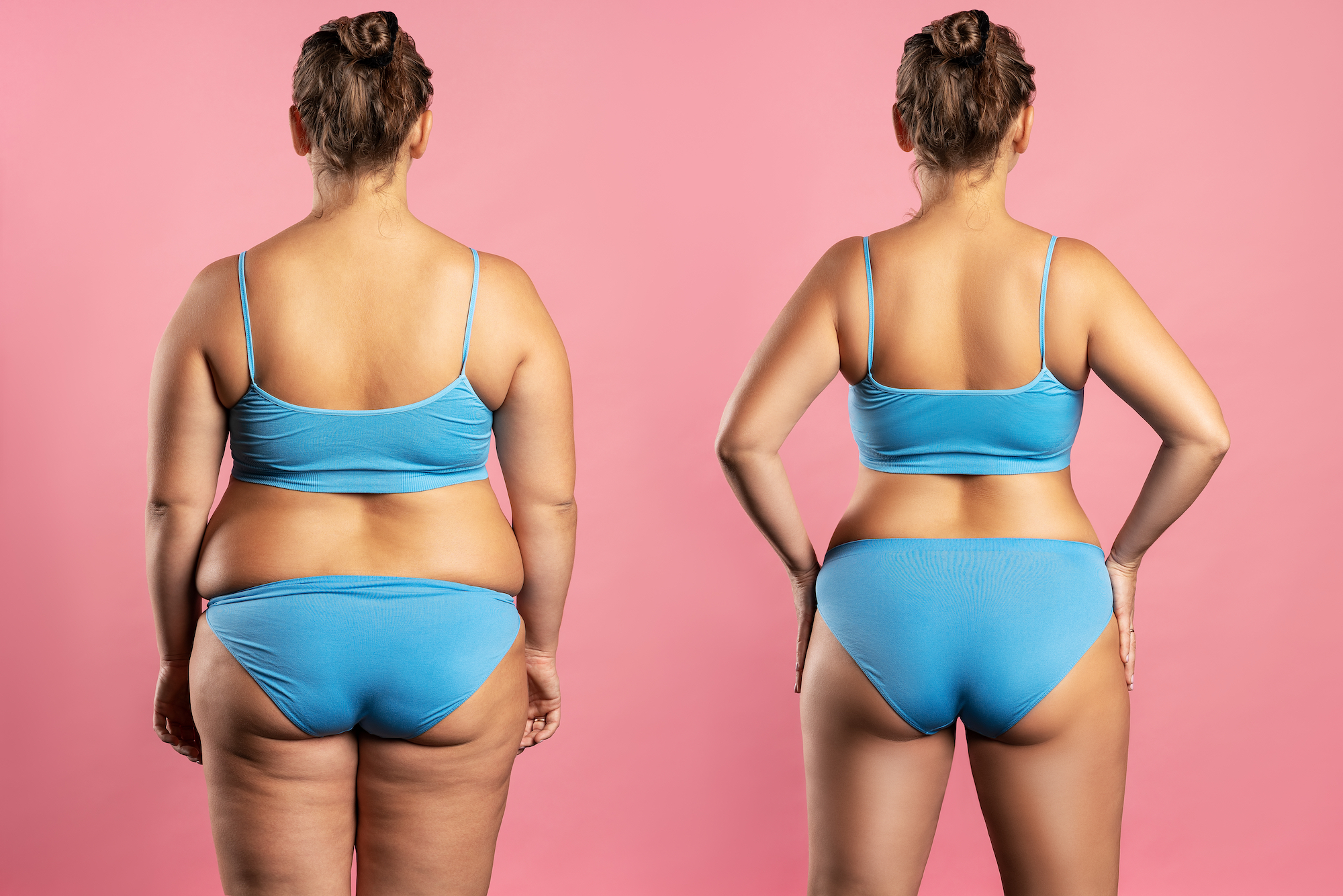 Before-After-Weight-Loss-Stock-Photo