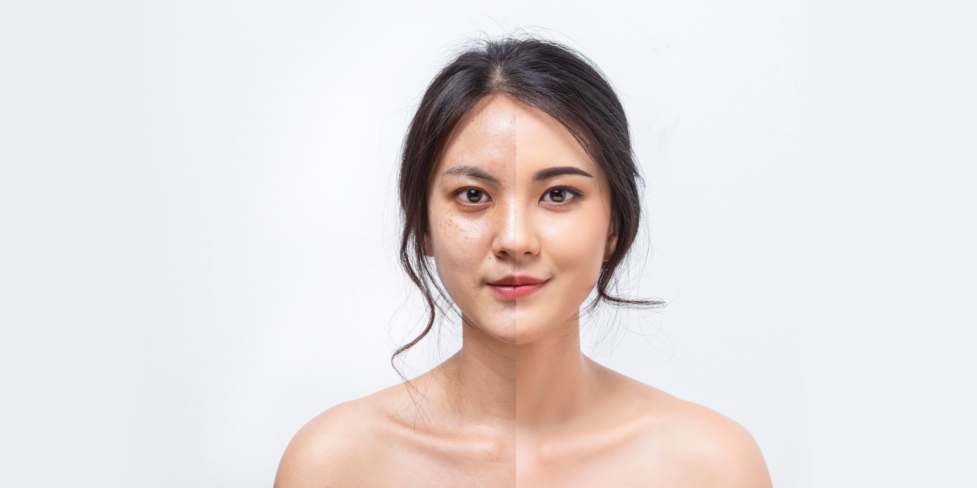 before-after-skin