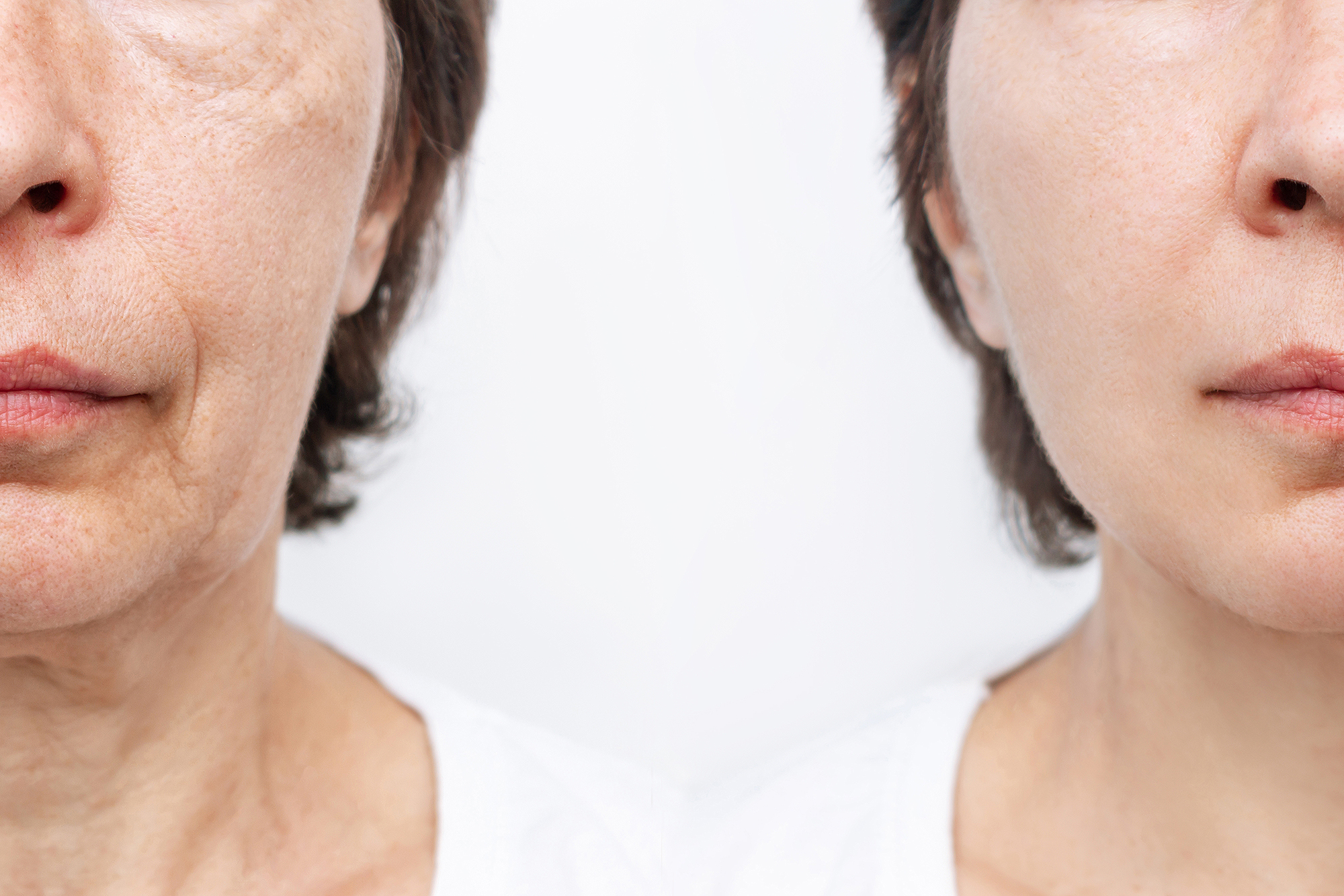 clinical-results-nasa-stem-cell-serum