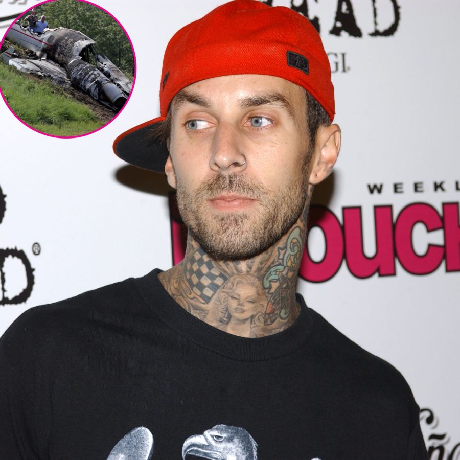 Travis Barker’s Health Ups and Downs Through the Years