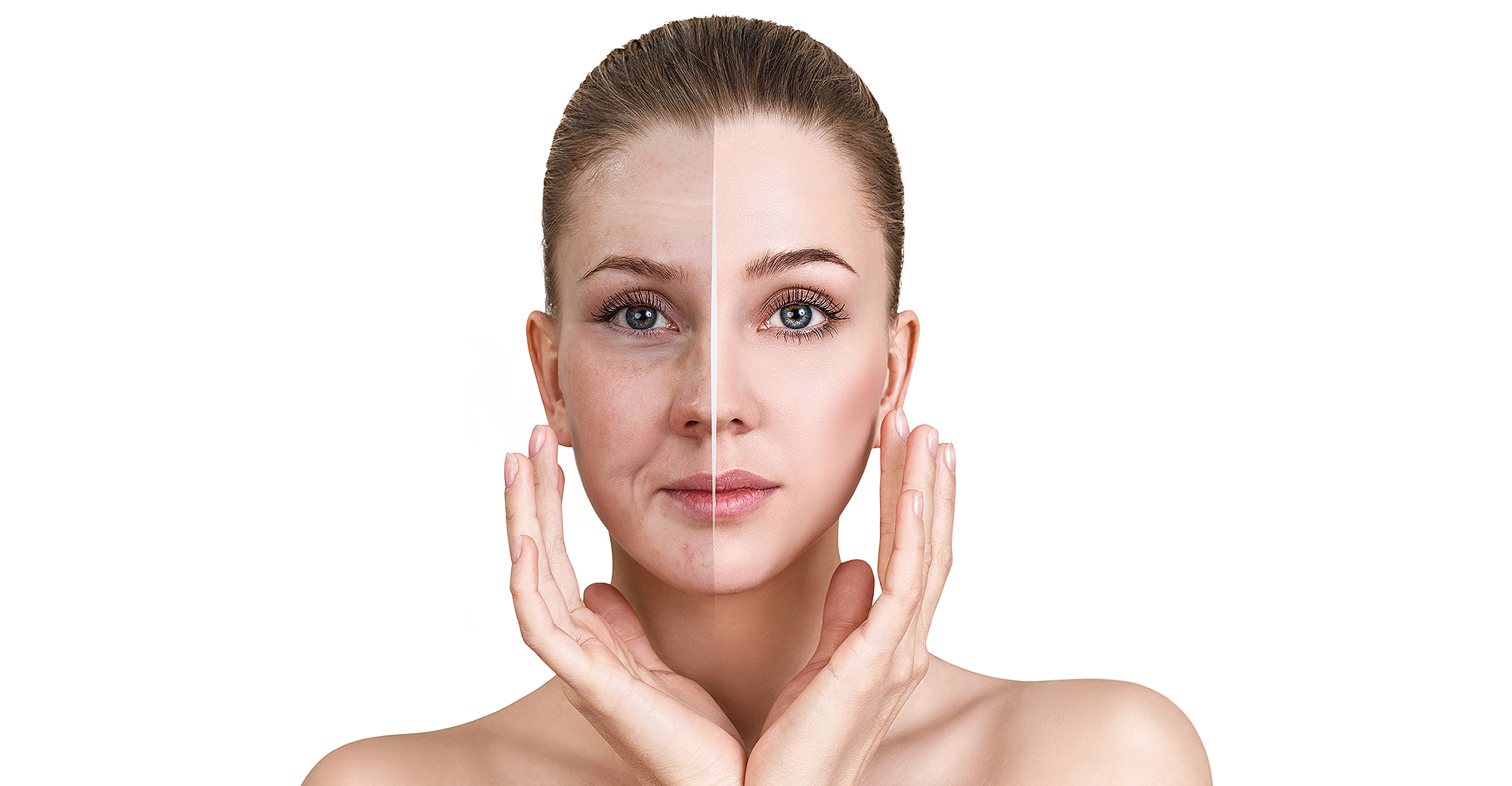 dry-skin-before-after