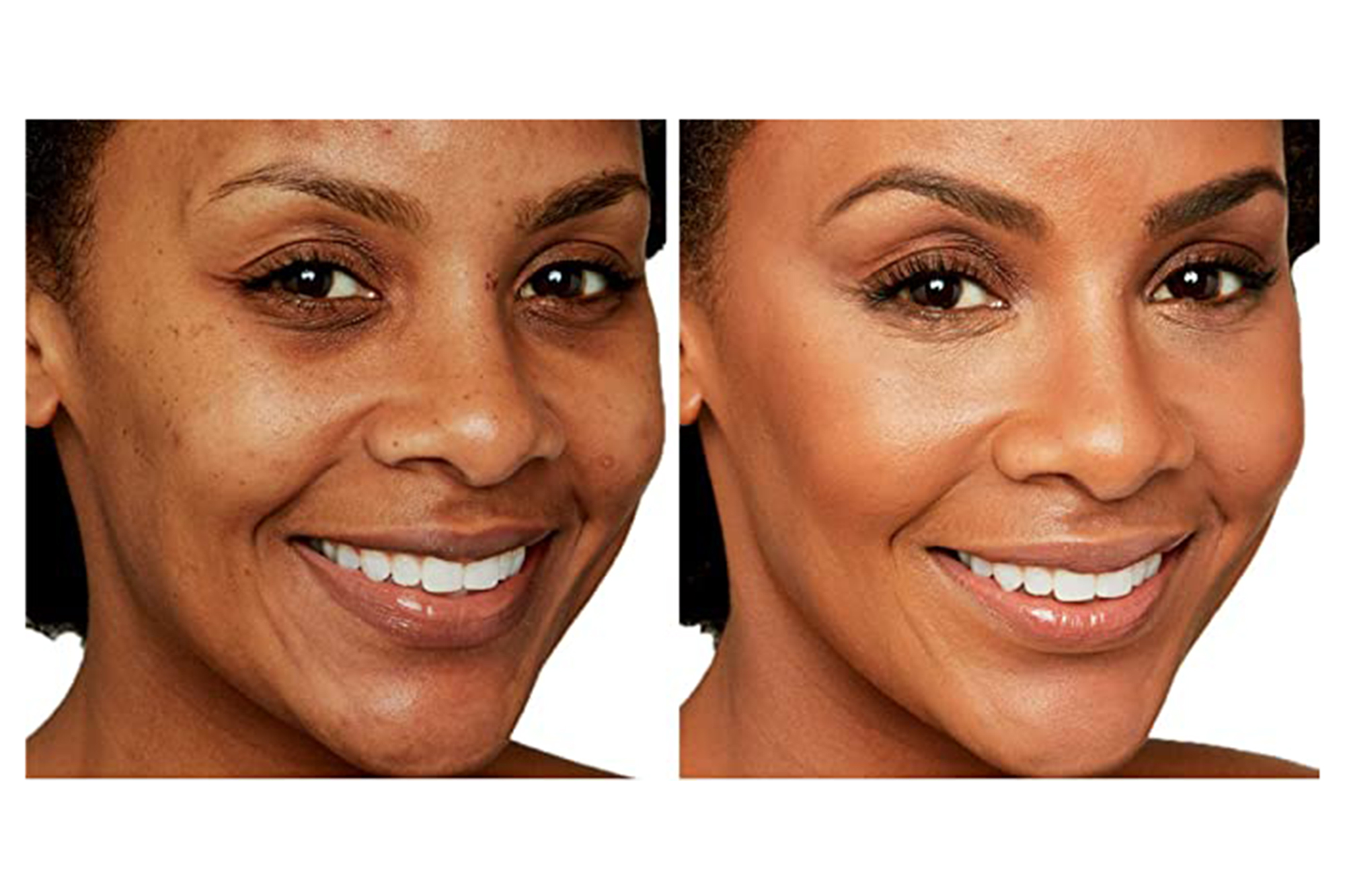IT Cosmetics concealer before and after