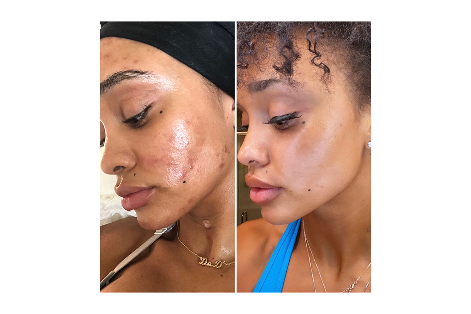 Gleamin before and after