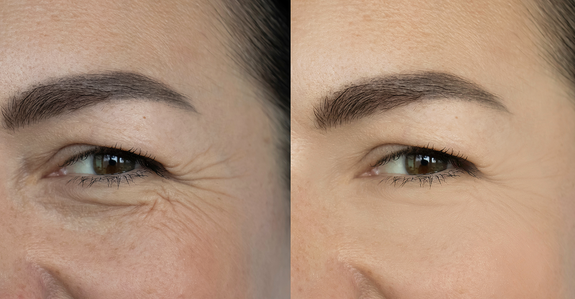 tula-eye-balm