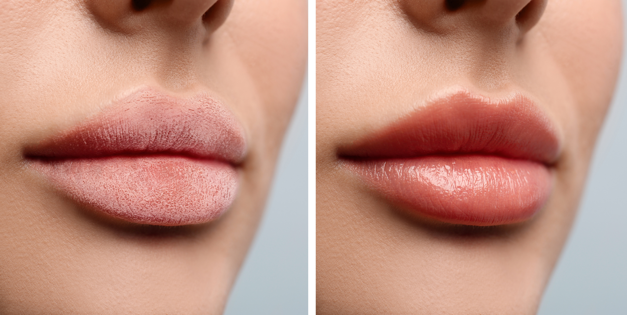 amazon-nooni-lip-oil