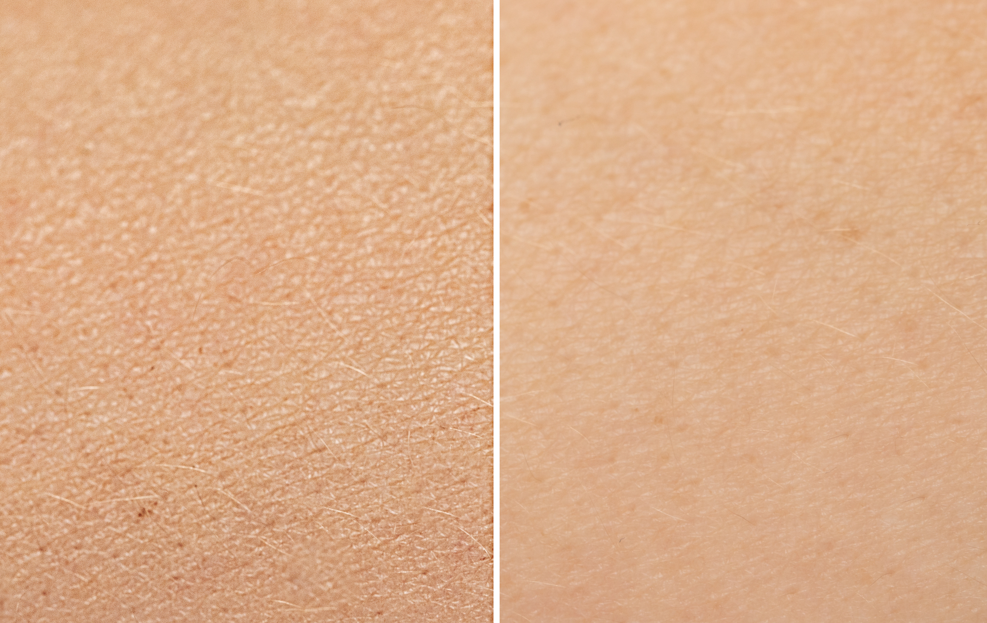 Before-After-Dry-Skin-Stock-Photo