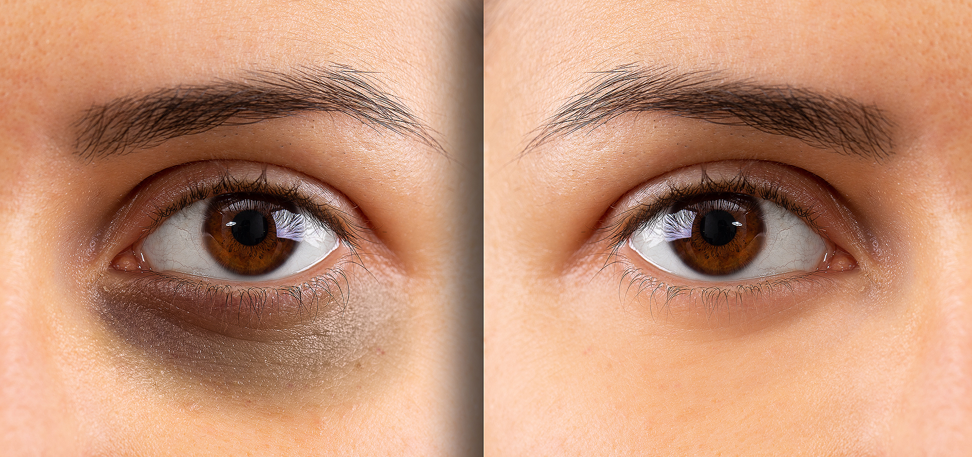 la-roche-posay-dark-circle-eye-cream