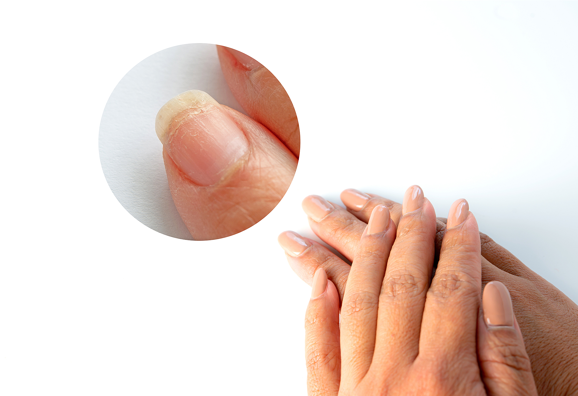 nail-cuticle-care-before-after