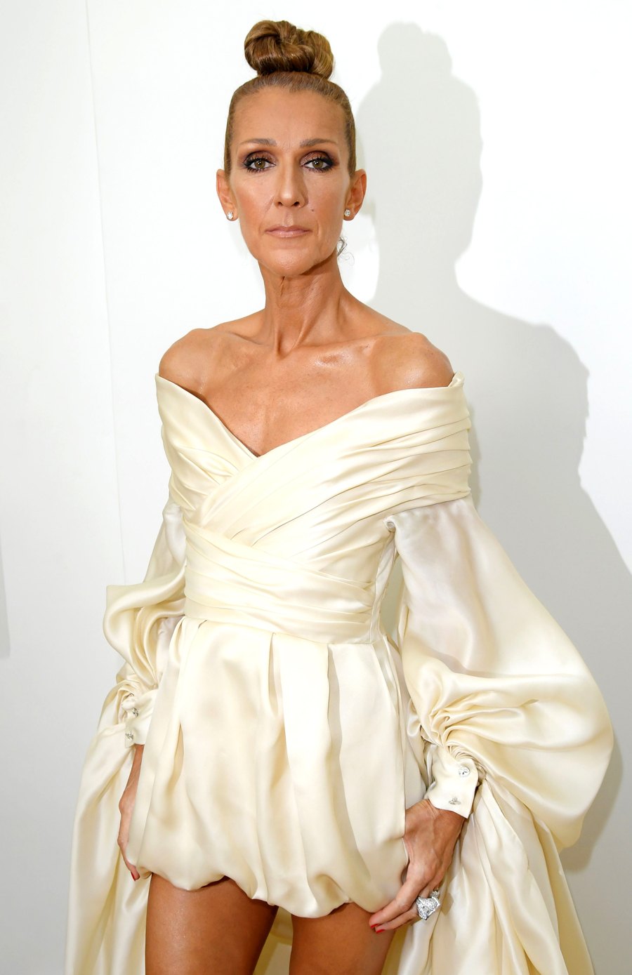 Celine Dion Diagnosed With Rare Neurological Disorder