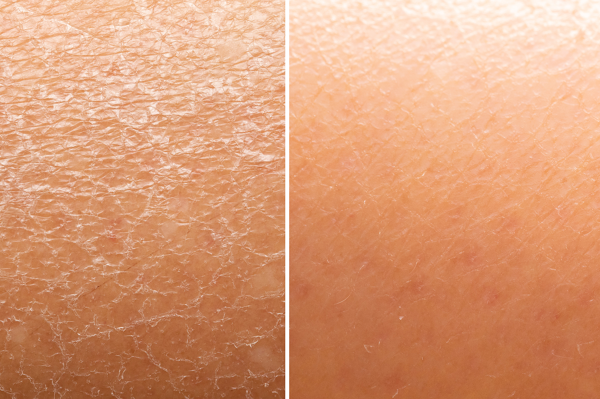 amazon-farmacy-honey-halo-moisturizer