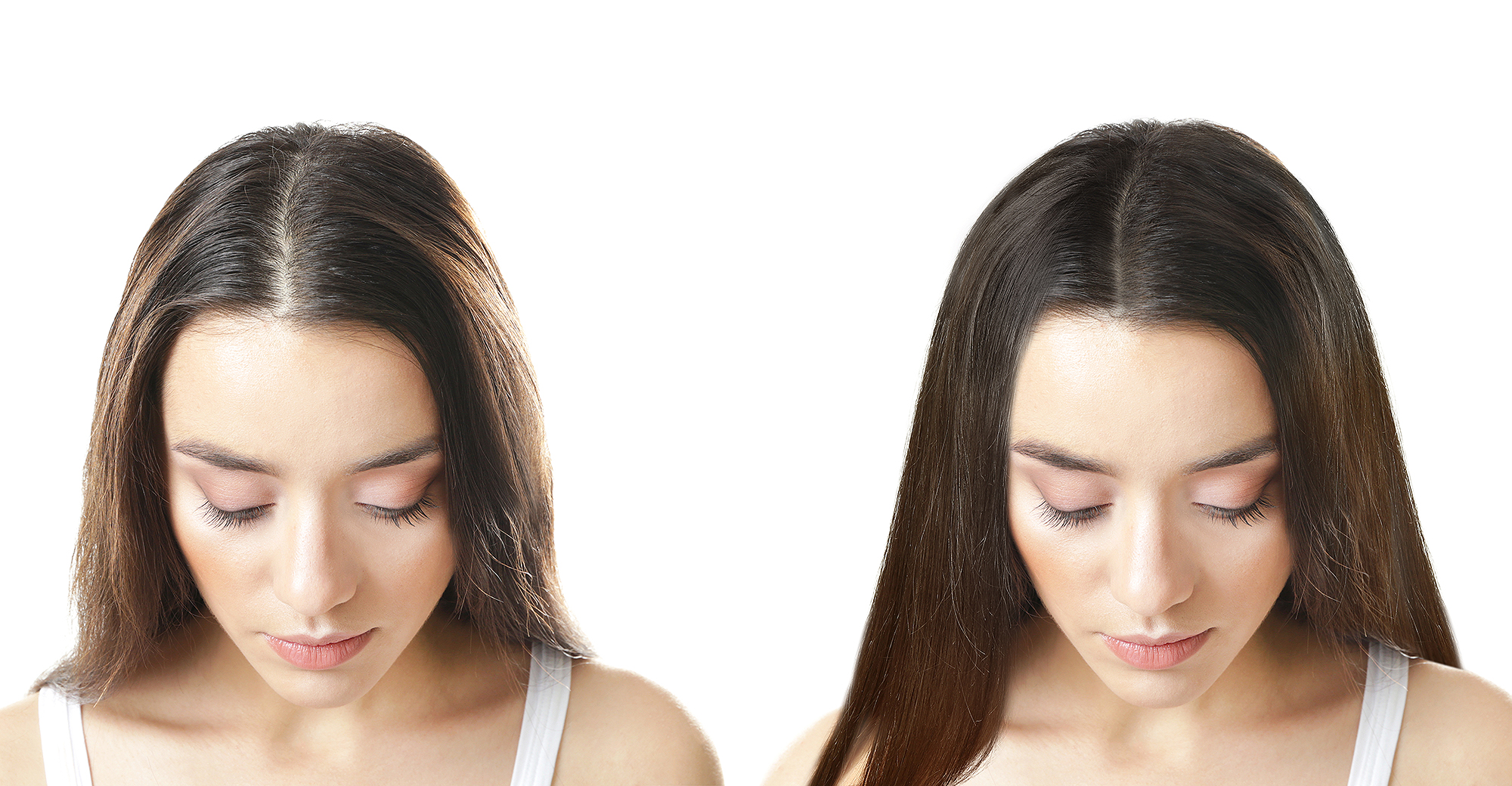 thin-hair-before-after