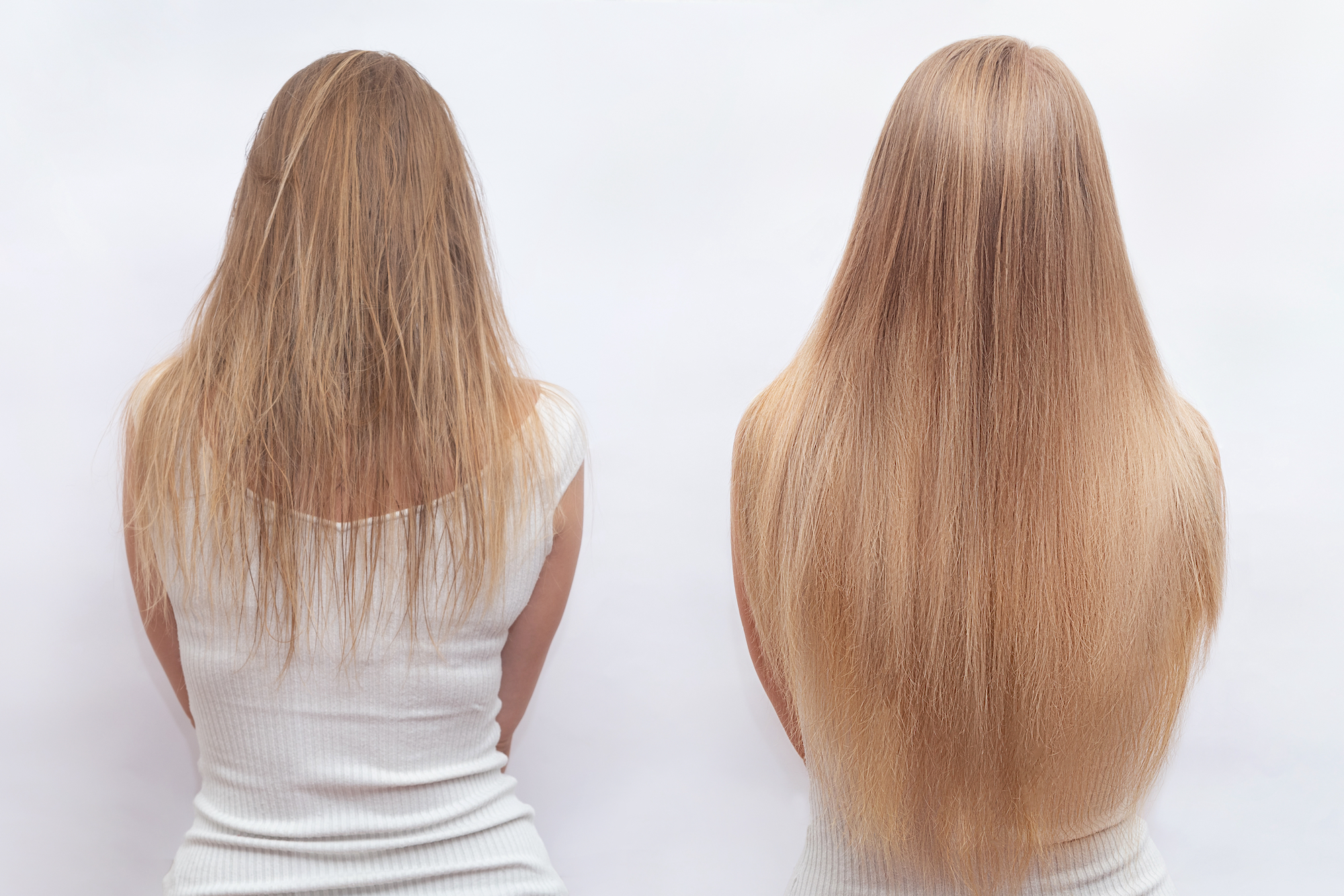 Before-After-Hair-Growth-Treatment