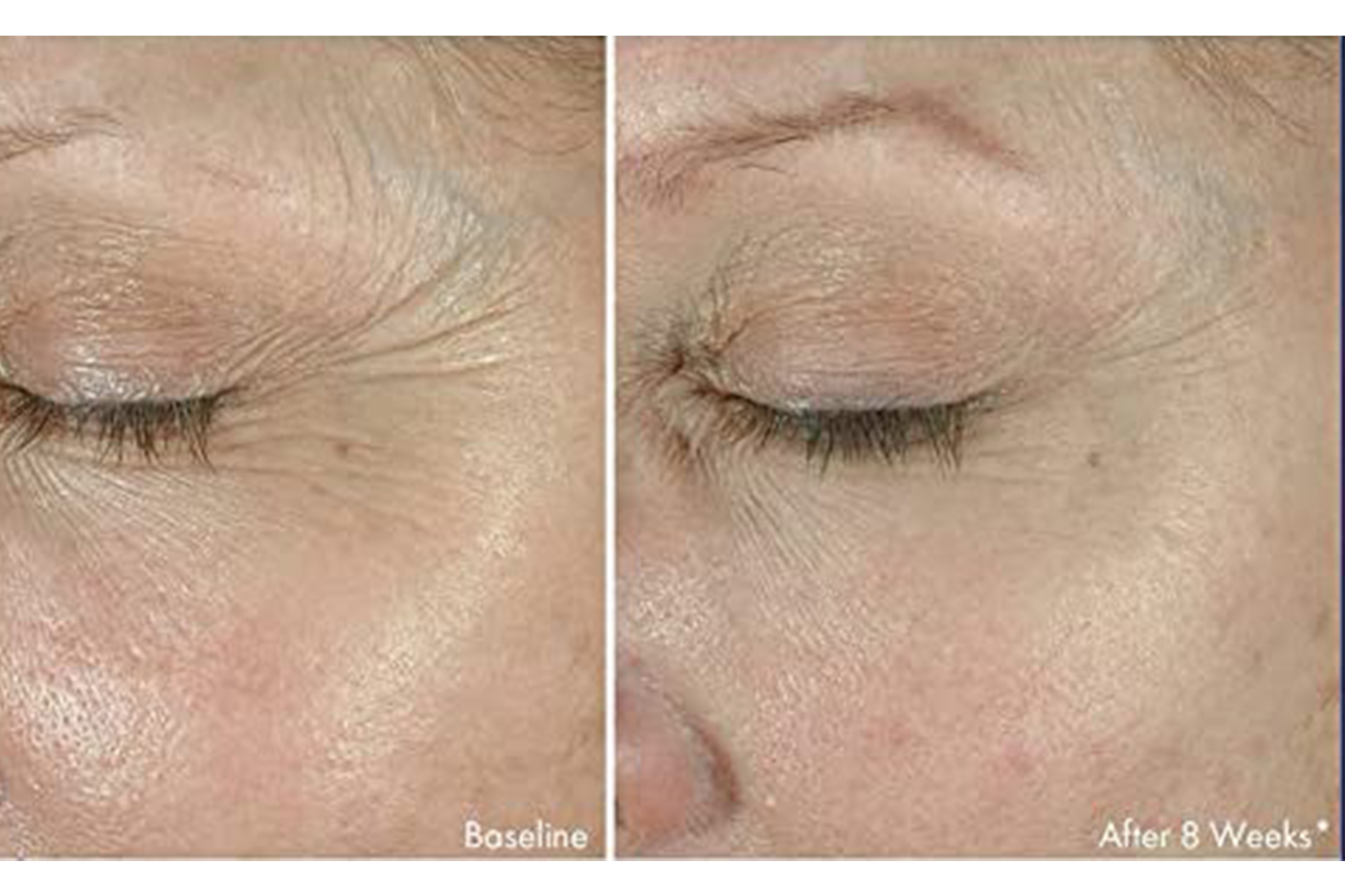 Obagi ELASTIderm Eye Cream