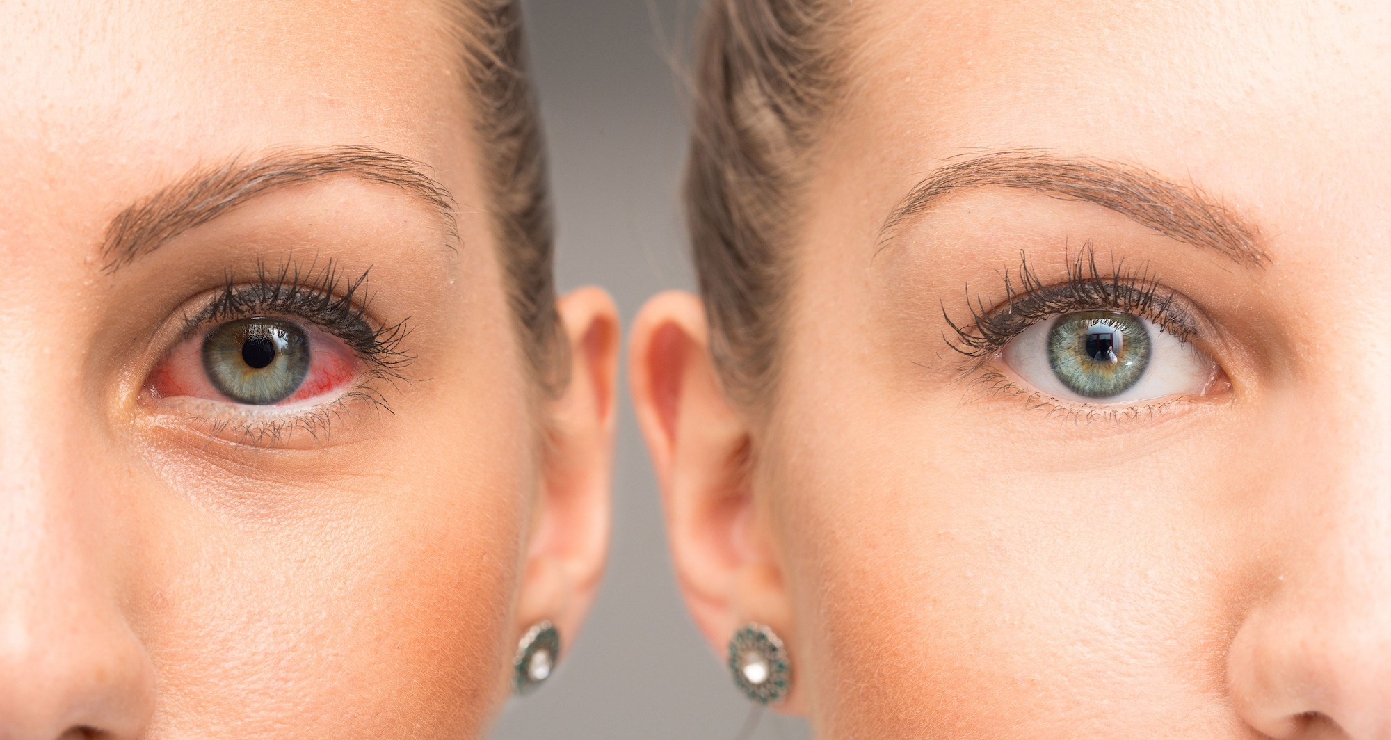 Tired-Eyes-Stock-Photo