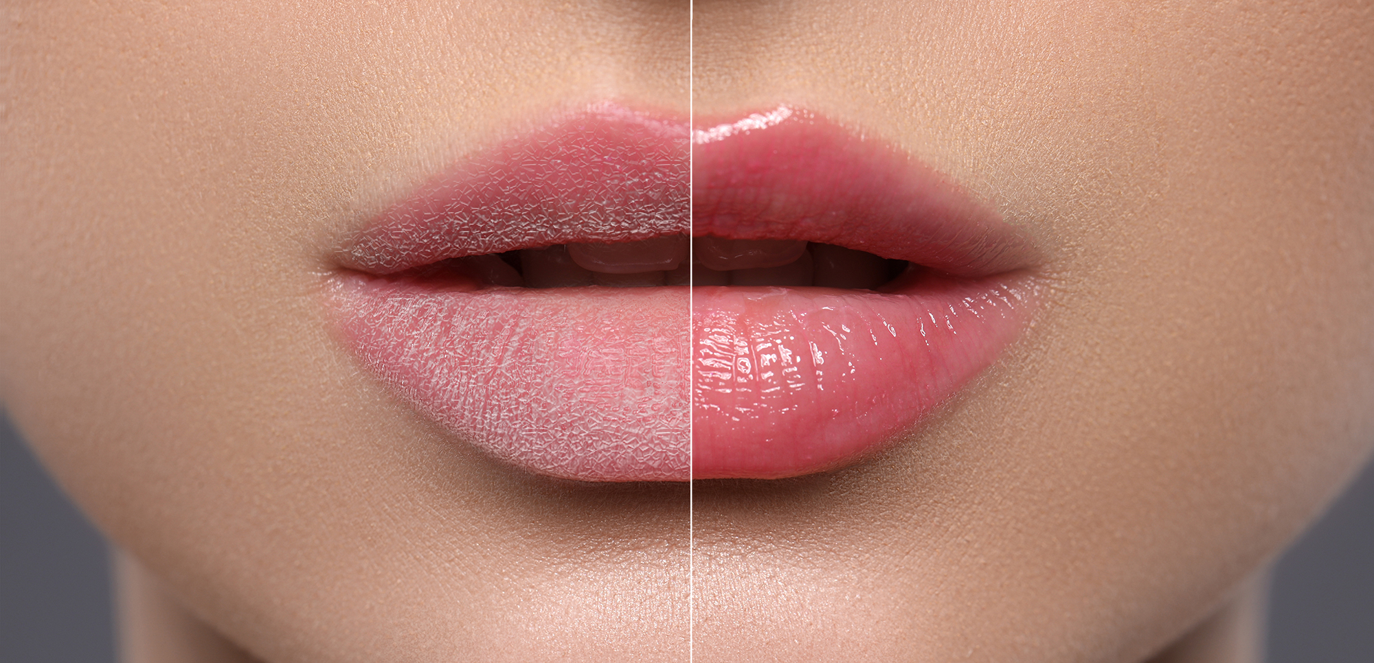 sandpaper-lips