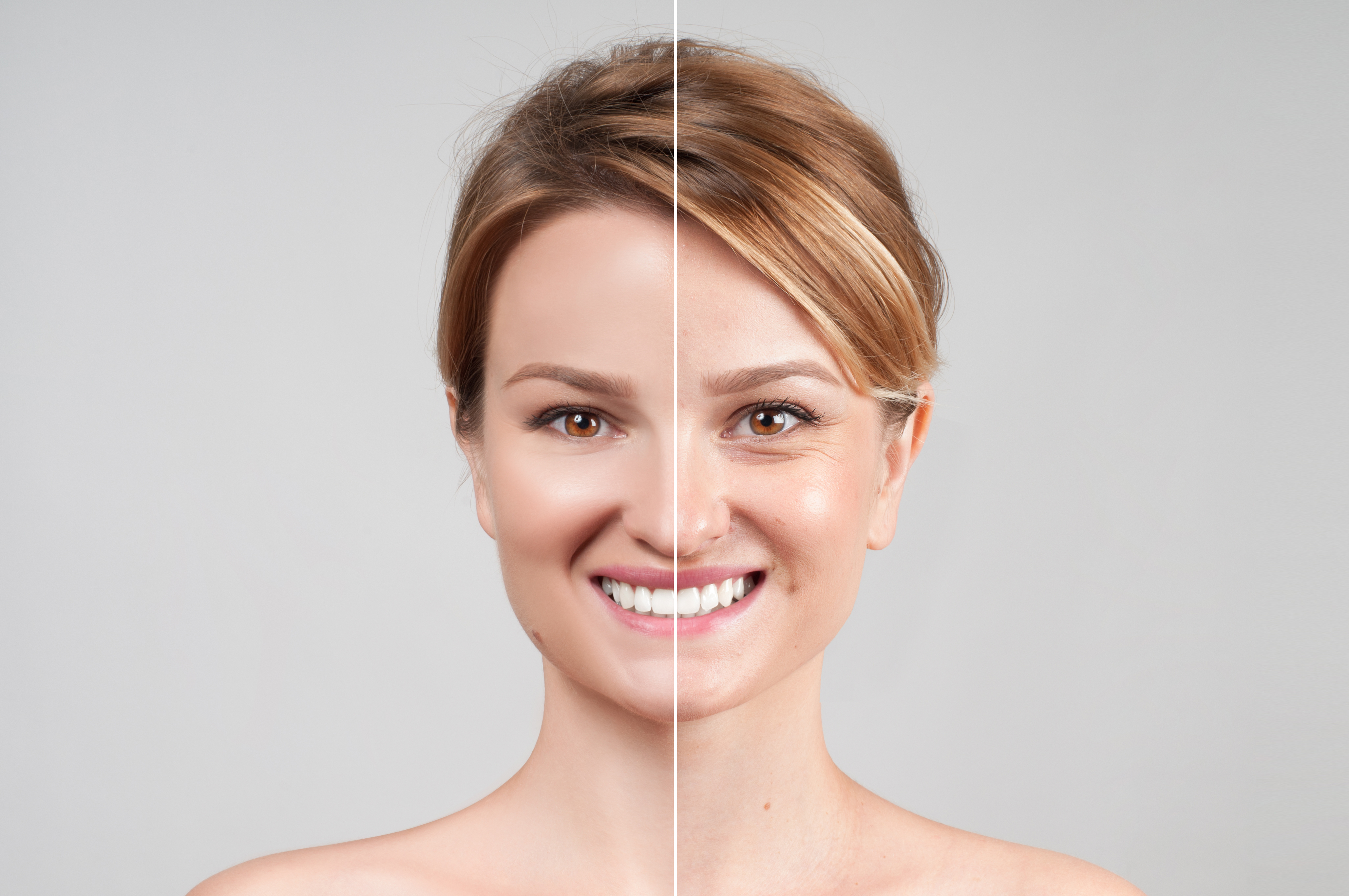 skin before and after