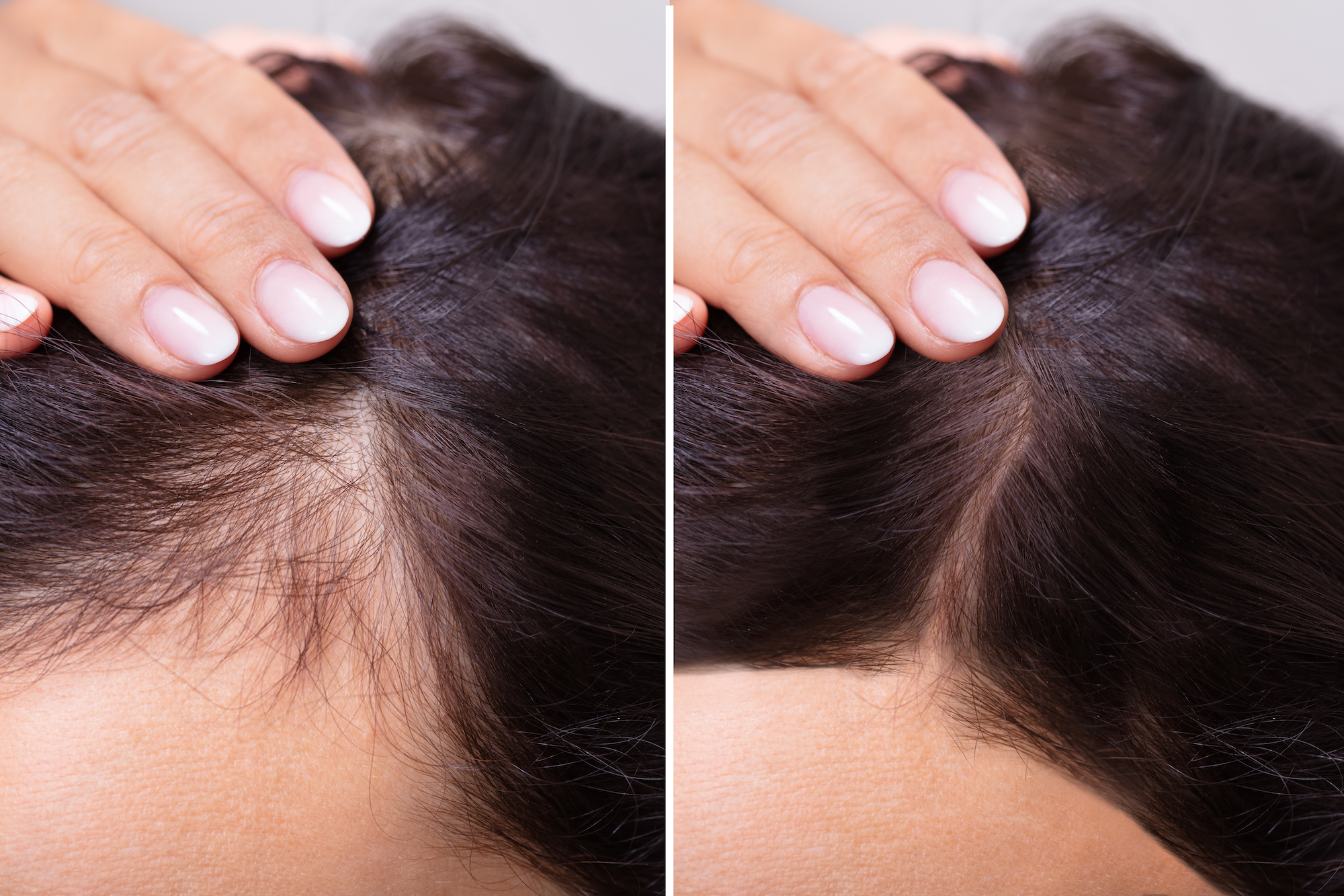 Viviscal Hair Growth Supplement Has Helped Shoppers Reduce Shedding