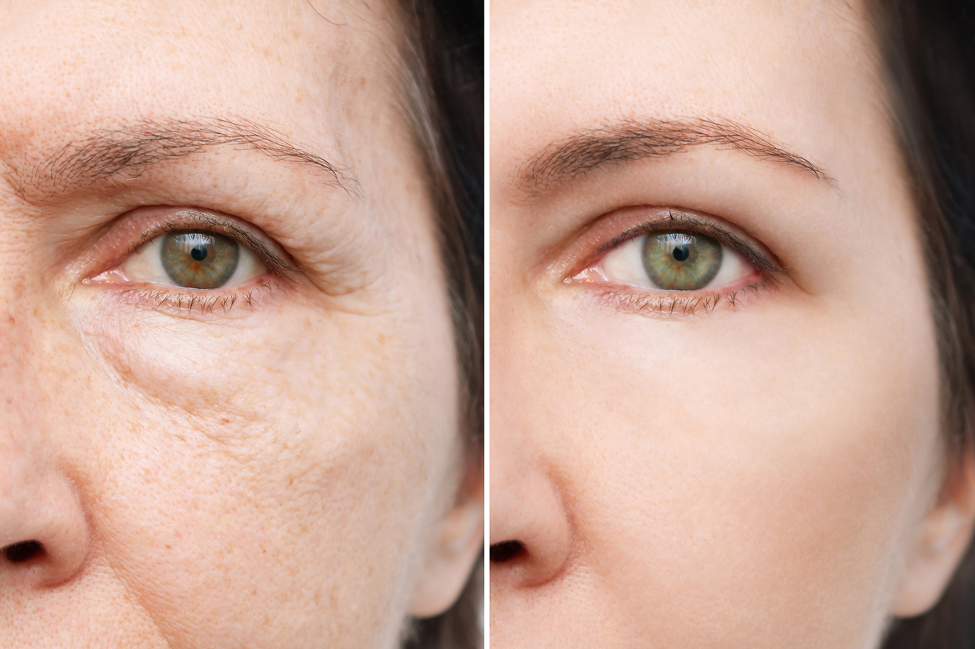 amazon-it-cosmetics-confidence-in-a-cream