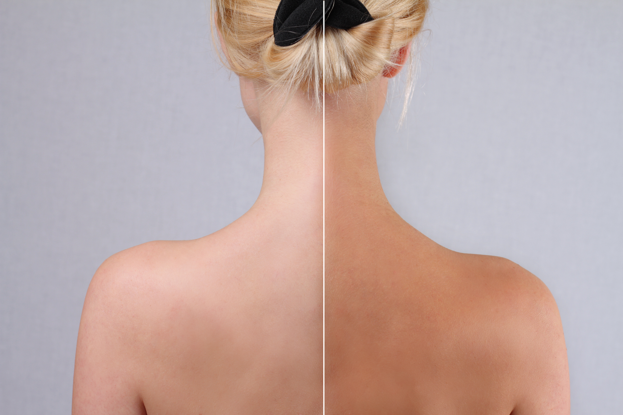 Self-Ran-Before-After-Results-Stock-Photo