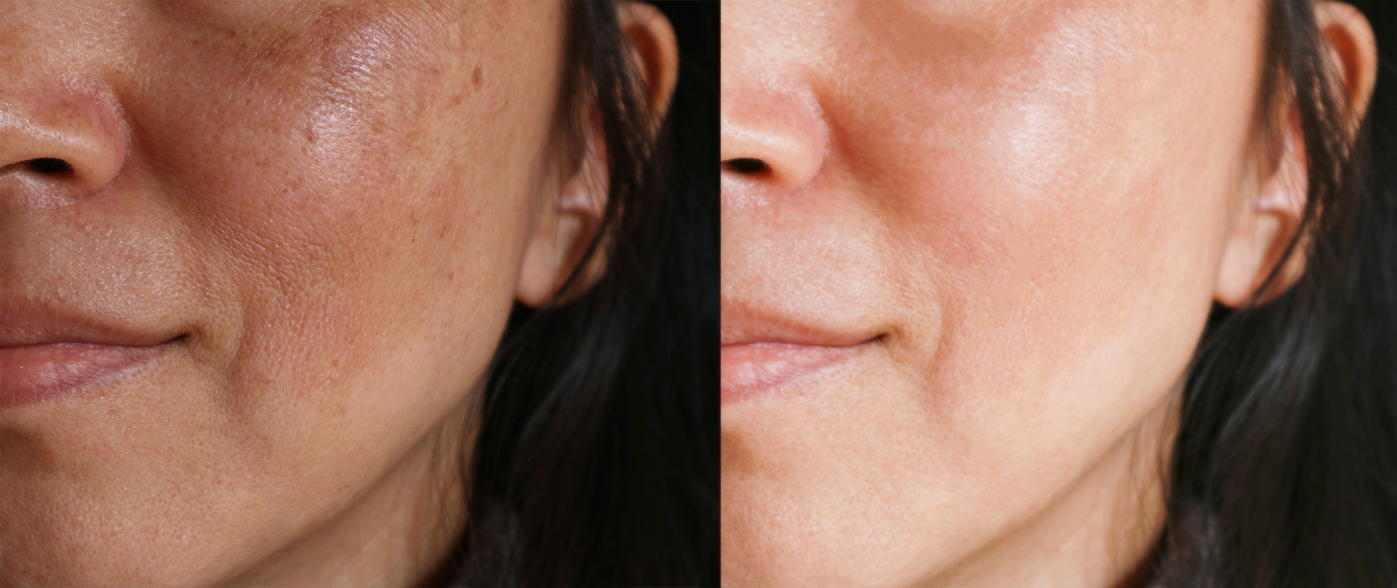 amazon-goodal-vitamin-c-serum