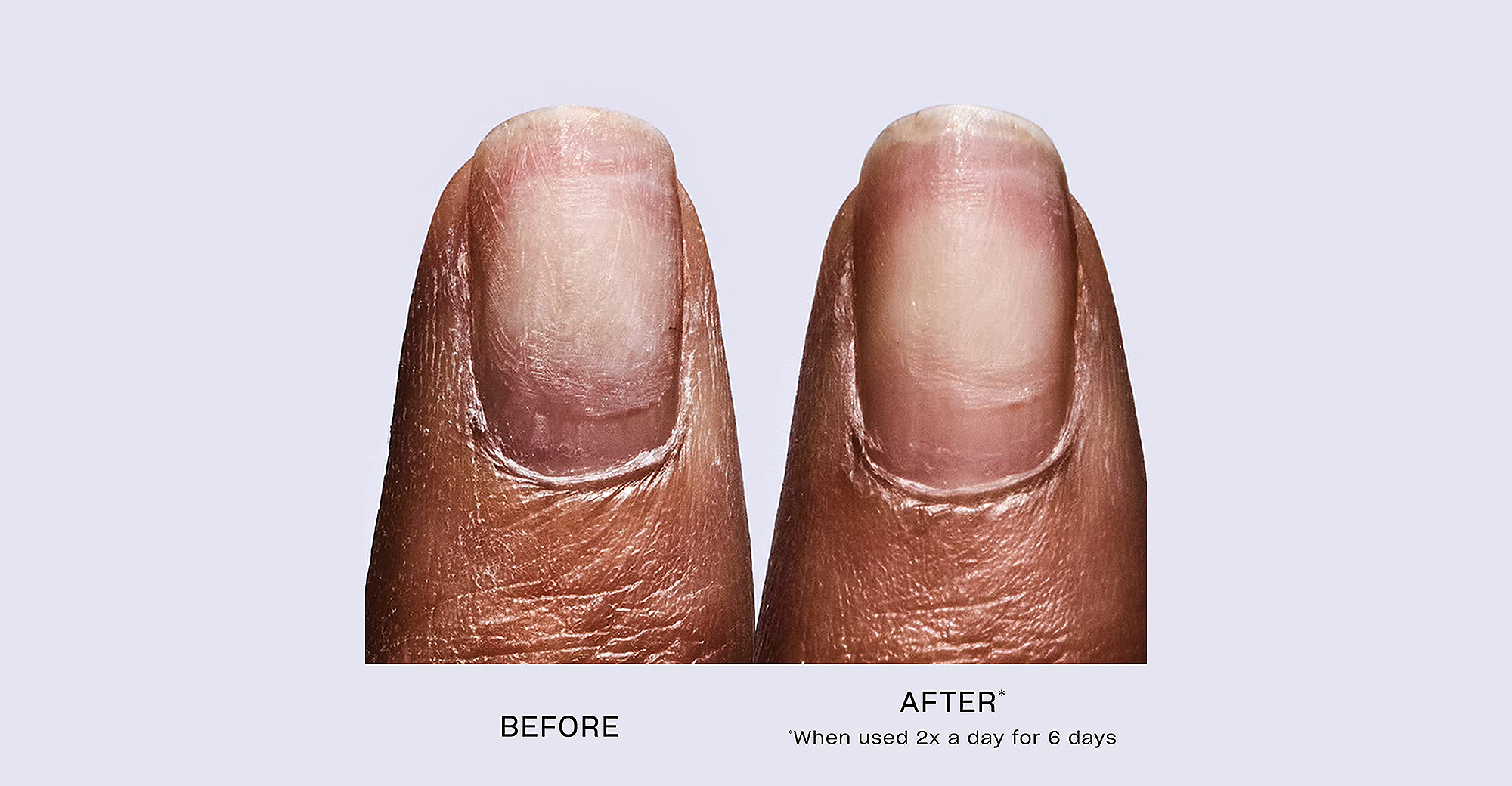 amazon-opi-repair-mode-nail-serum