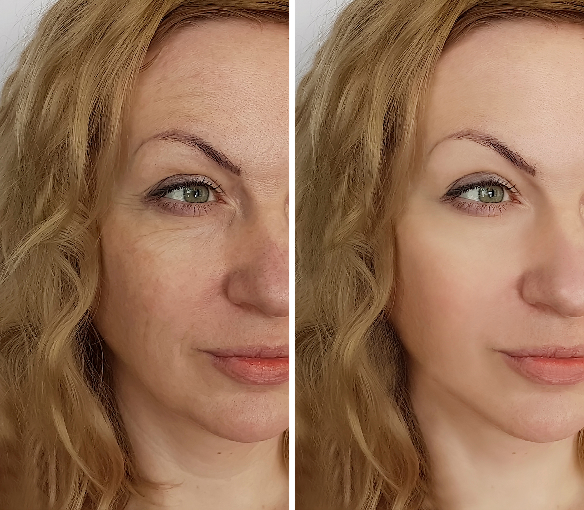 cosrx-retinol-cream
