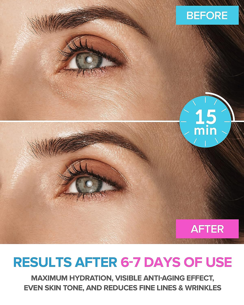 amazon-maree-eye-gels-results