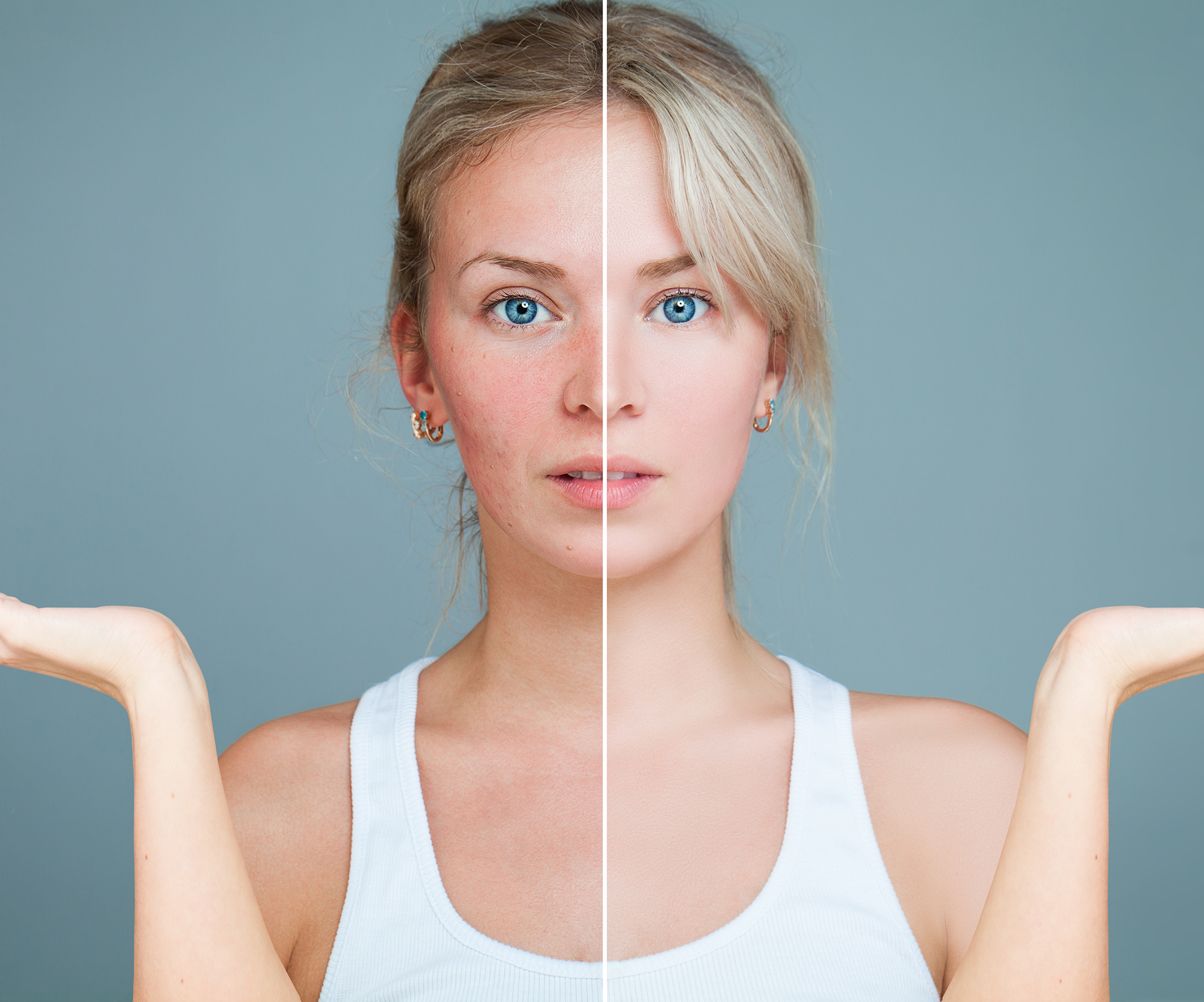 amazon-embryolisse-cream