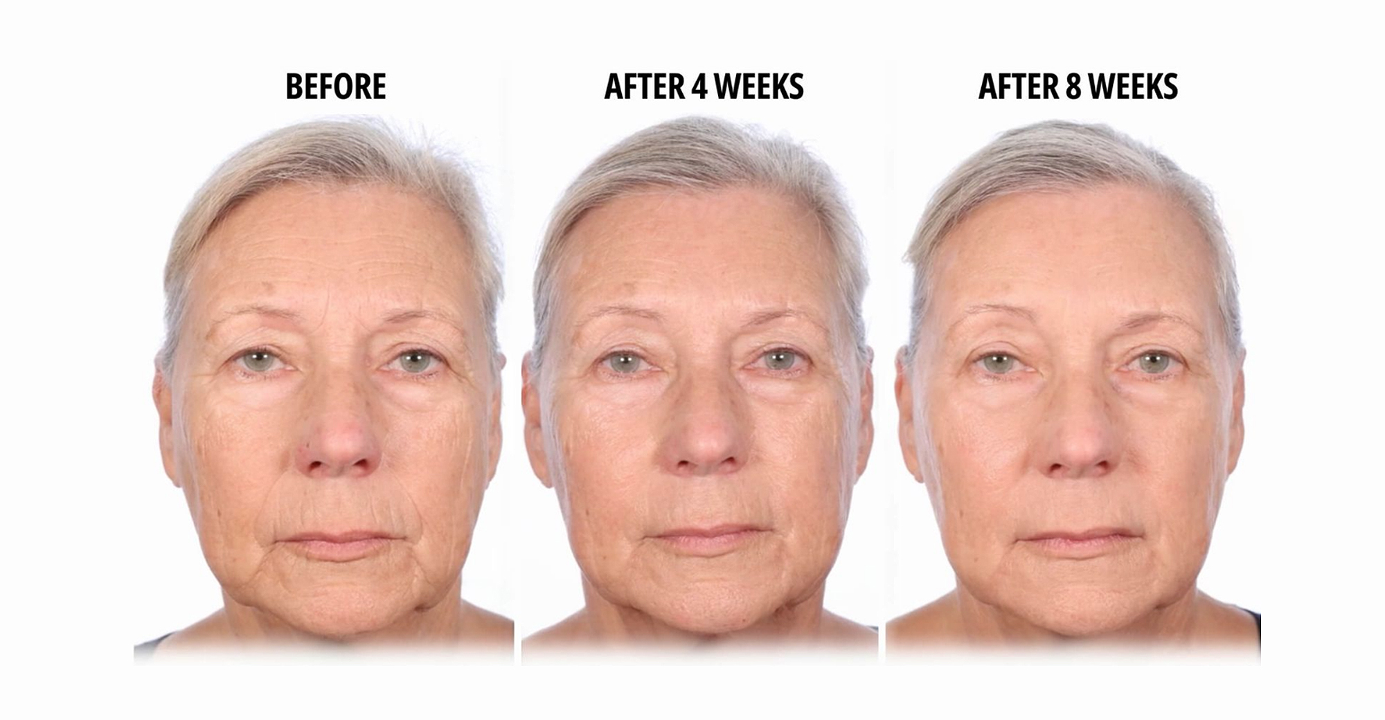 serious-skincare-trace-erase