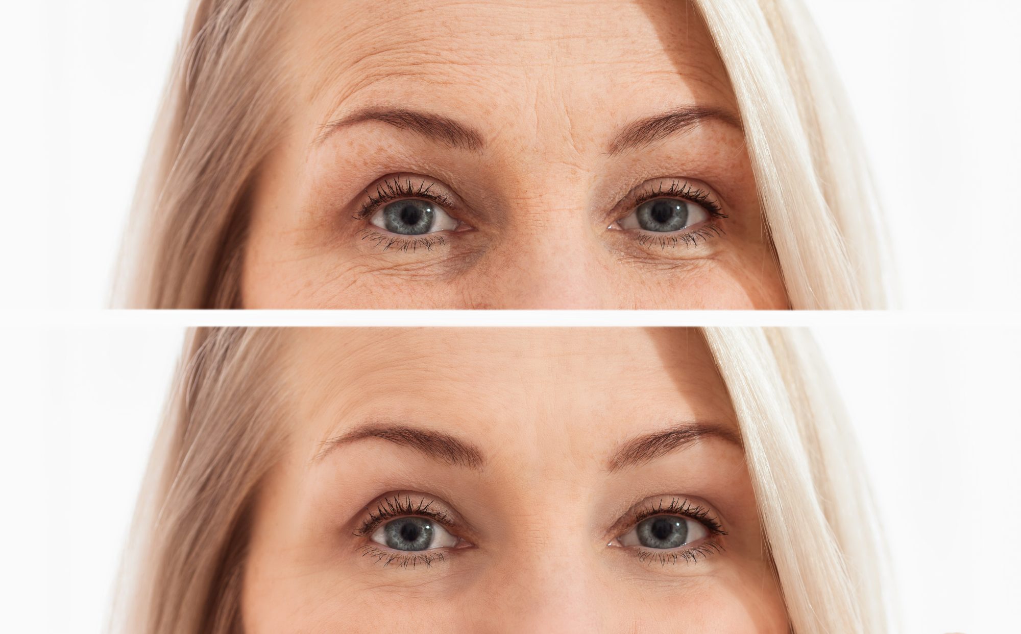 eye cream before and after