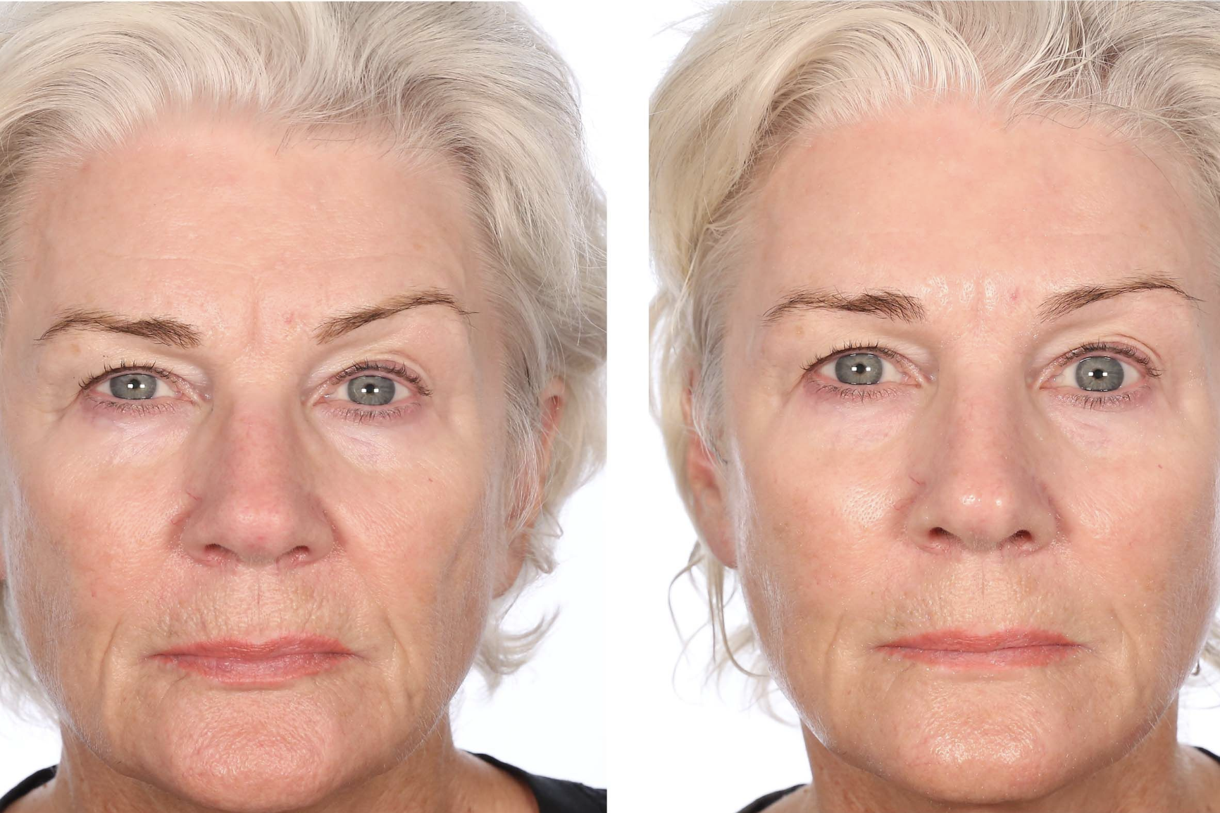 Serious-Skincare