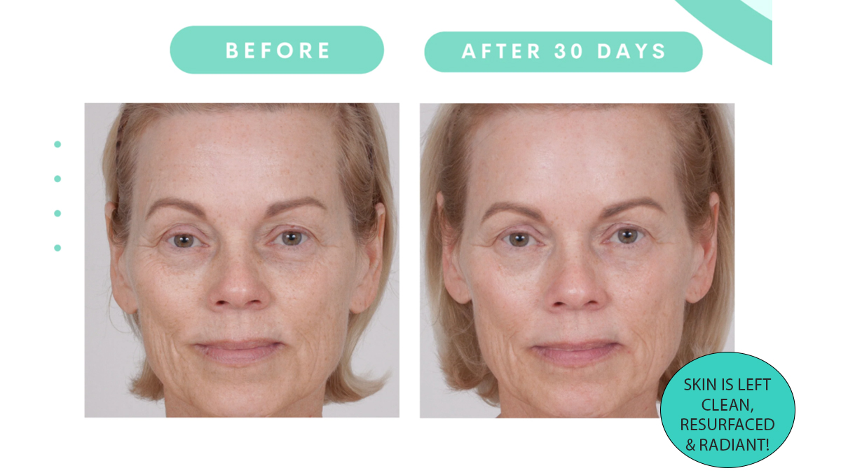Serious Skincare