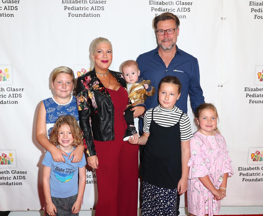 Tori Spelling s Son Liam McDermott Undergoes Foot Surgery 268