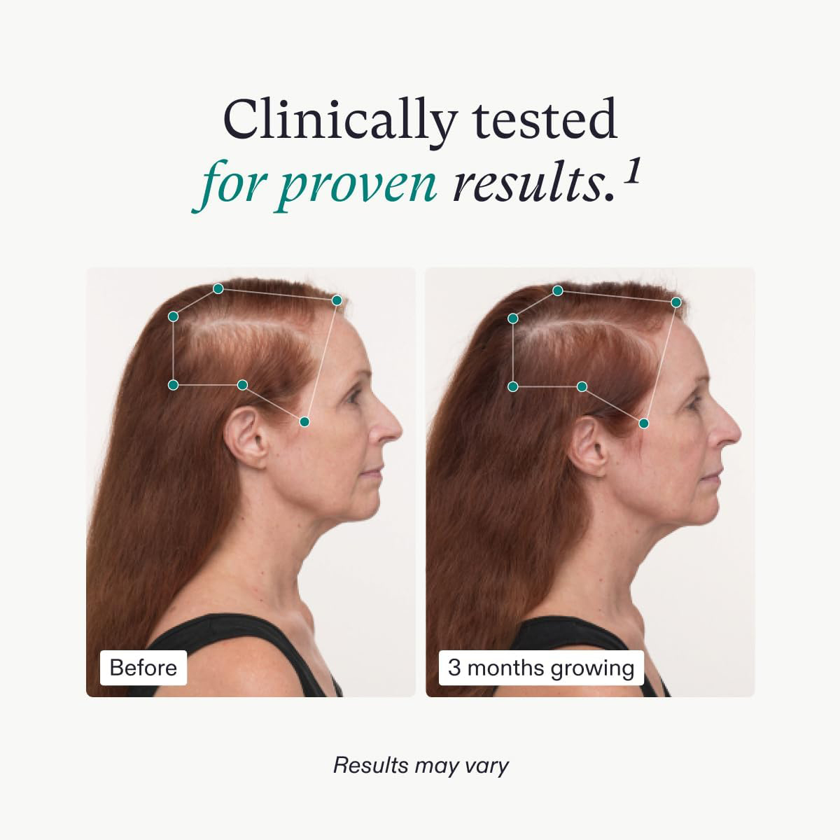 amazon-nutrafol-results