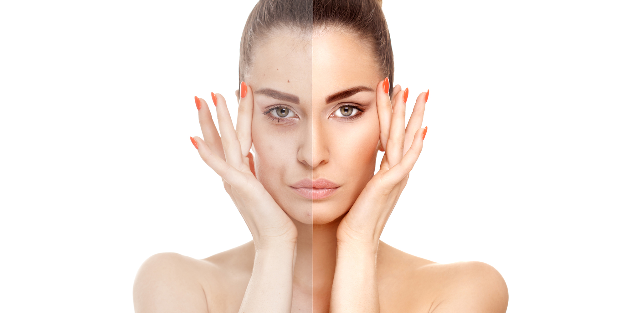 Close-up of a woman face divided in two parts - no retouch with red skin and acne and good beauty retouch.