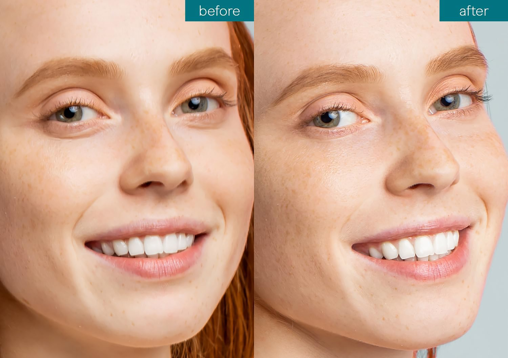 amazon-baebody-eye-gel-before-after