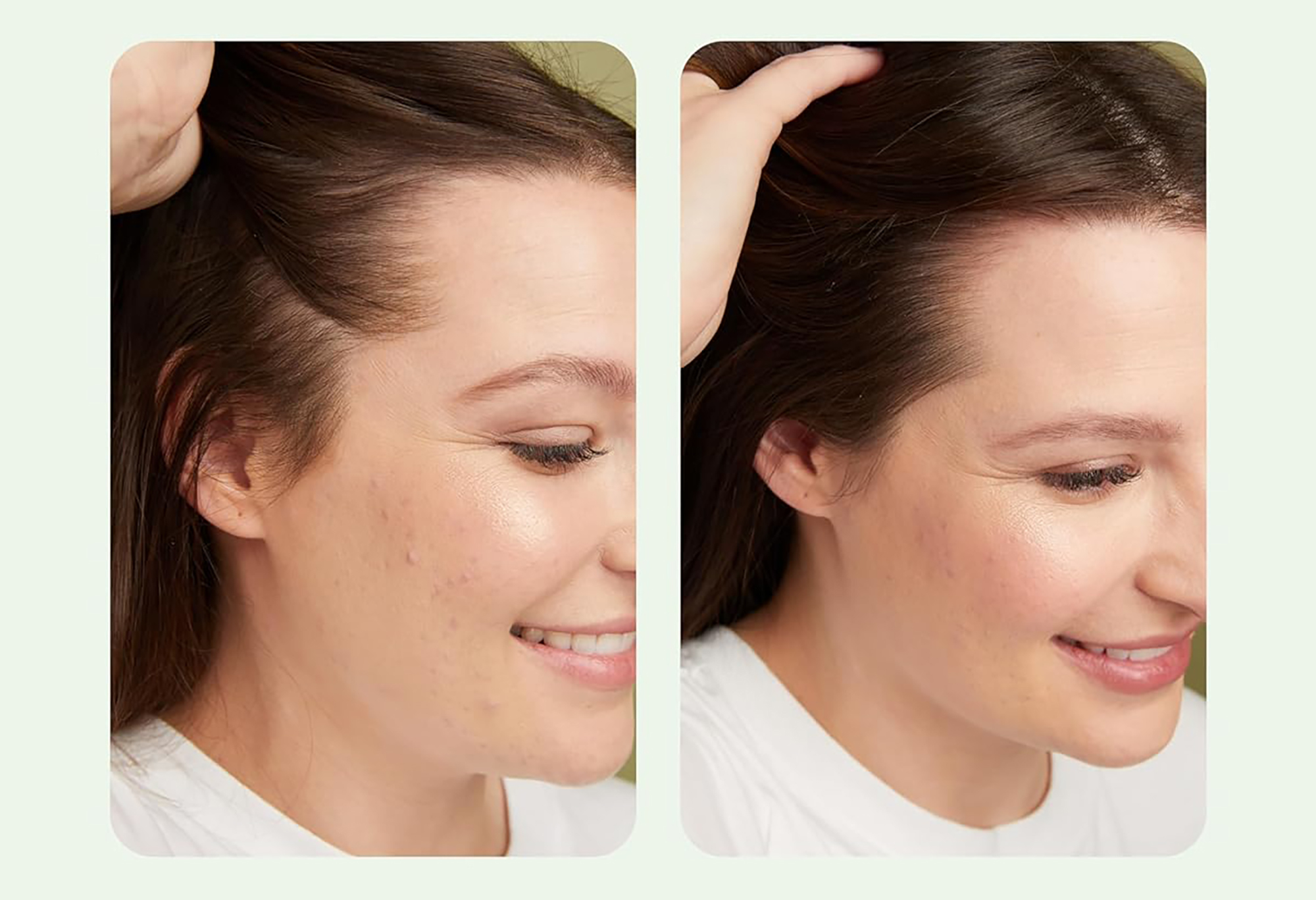 amazon-divi-scalp-serum-before-after