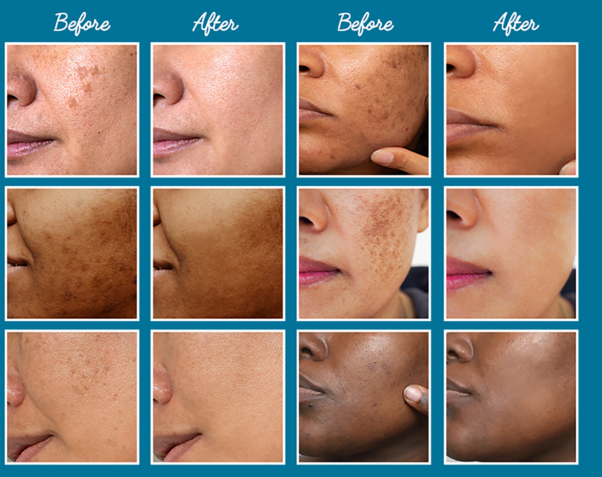 neutralyze-dark-spot-remover