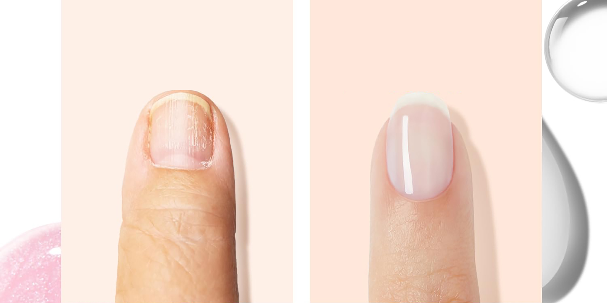amazon-modelones-nail-ridge-filler
