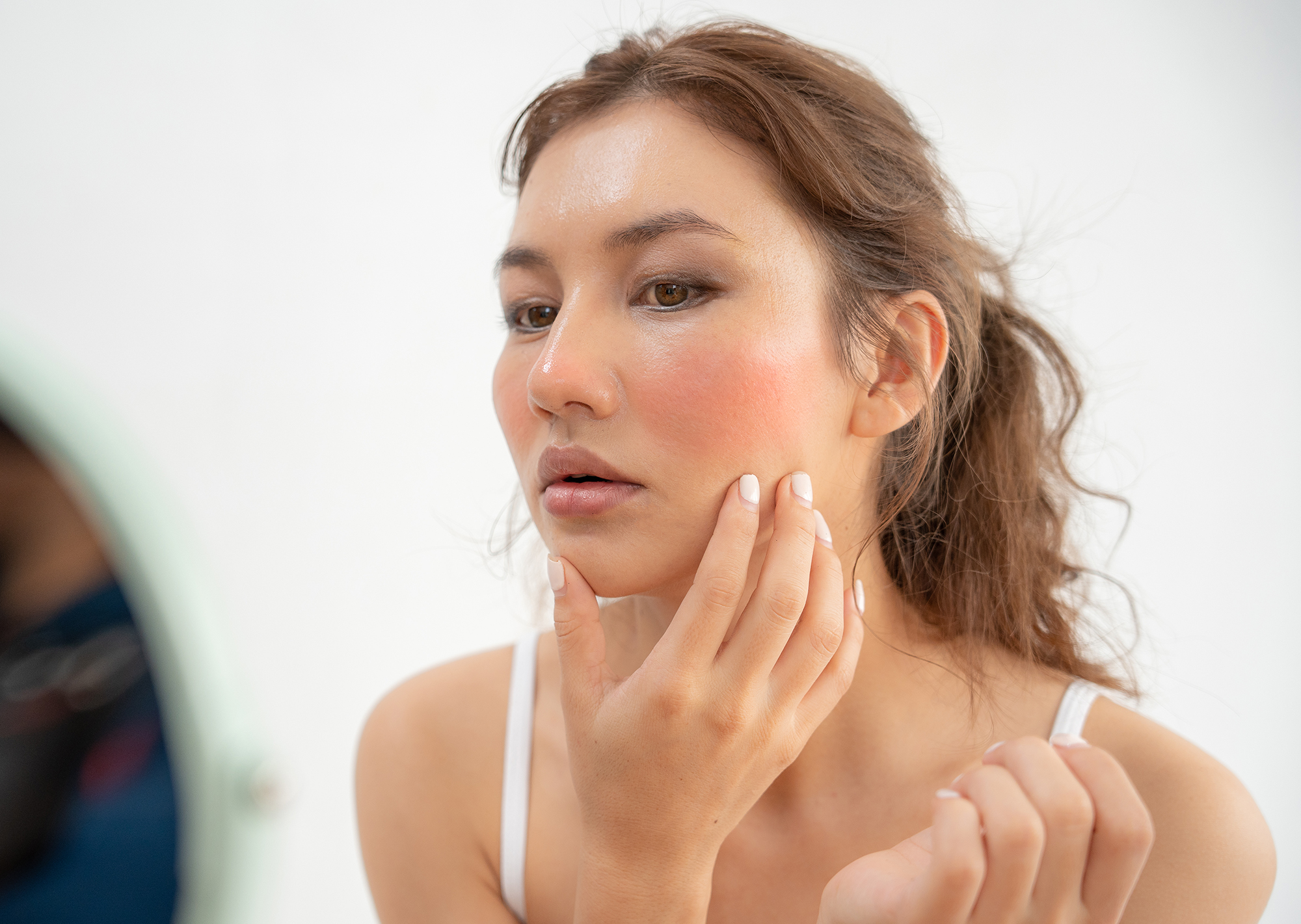 woman worried about face Dermatology and allergic to steroids in cosmetics. sensitive skin, red face from sunburn, acne, allergic to chemicals, rash on face. skin problems and beauty