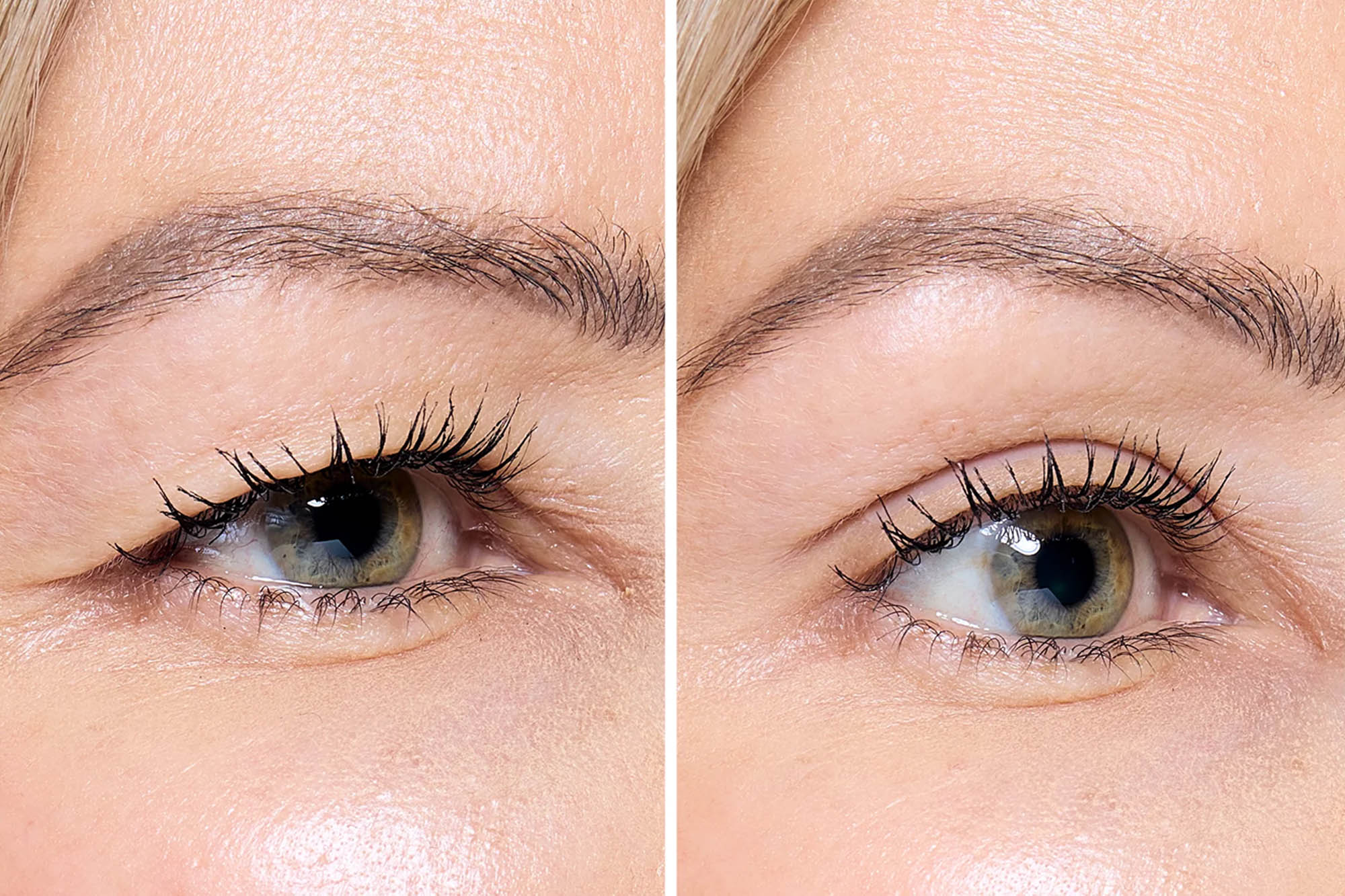 Eyelid Stickers