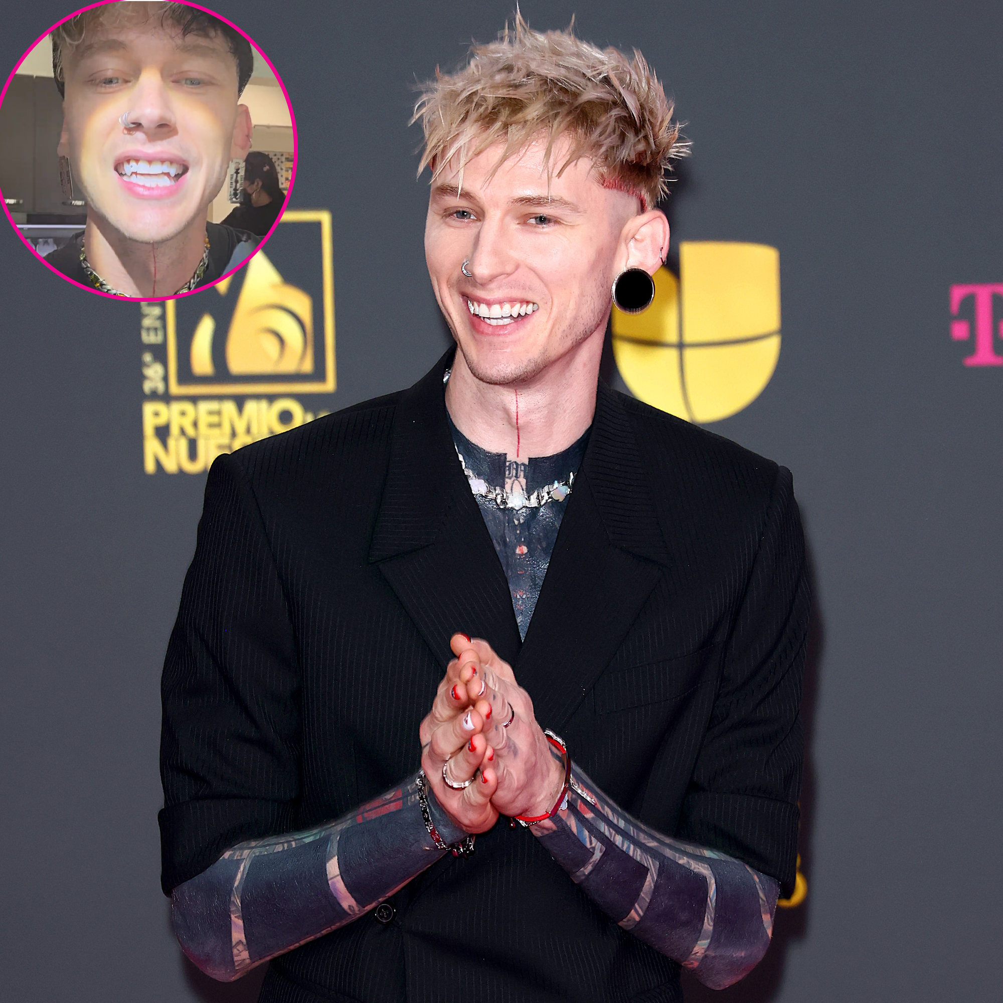 Machine Gun Kelly Shows Off New Fangs