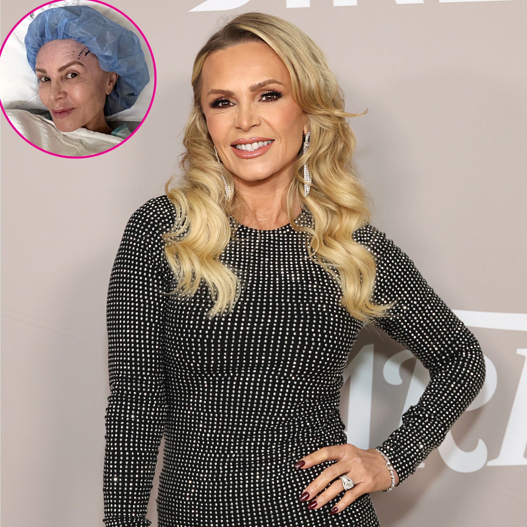 Tamra Judge Gets a Brow Lift