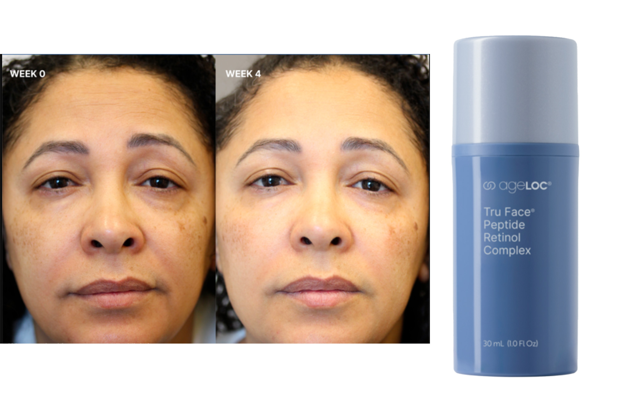 ageloc skin complex