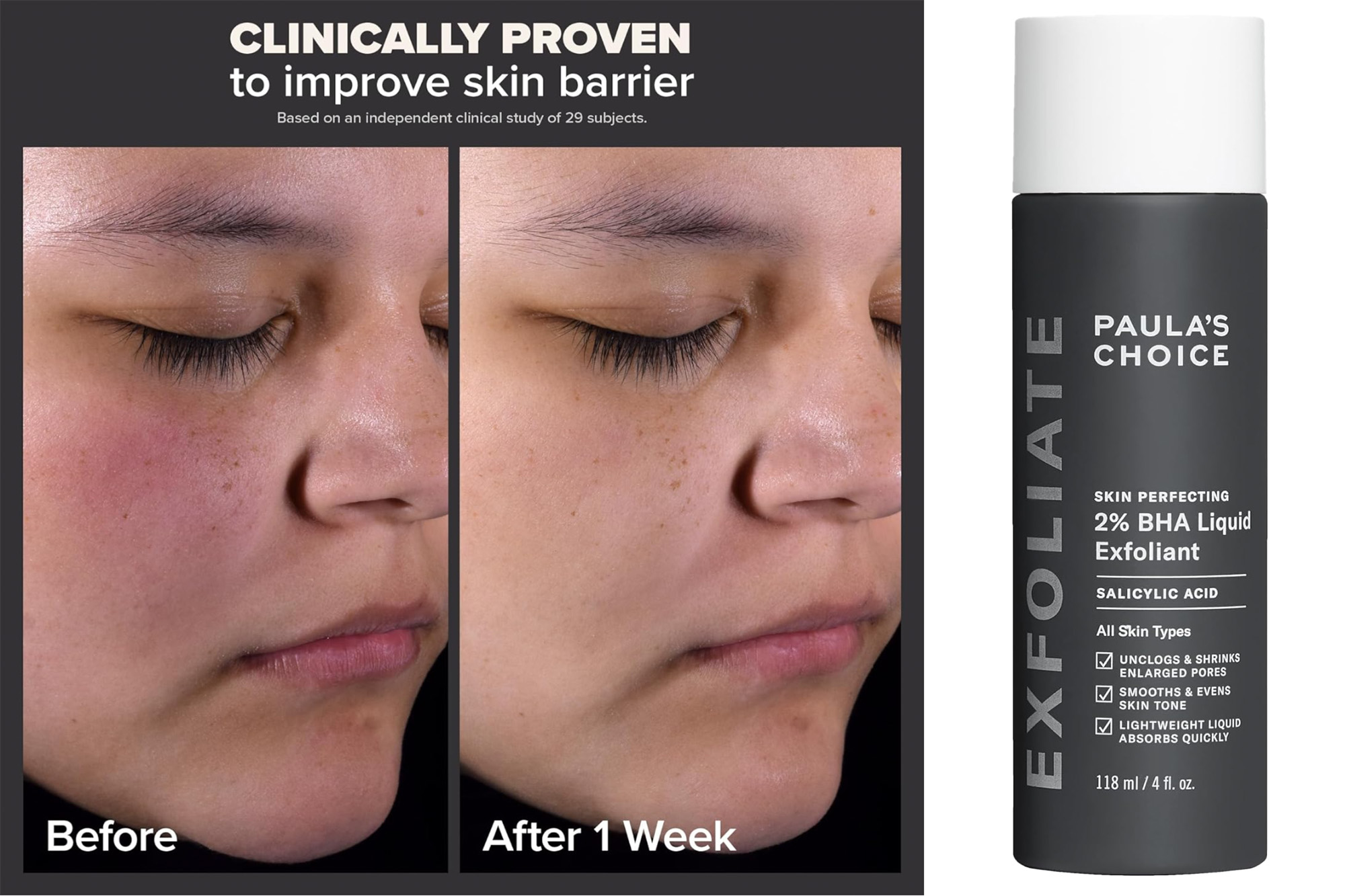 paula's choice exfoliant
