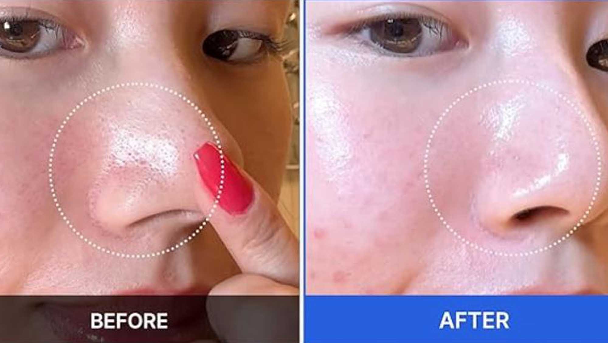 Medicube Toner Pads