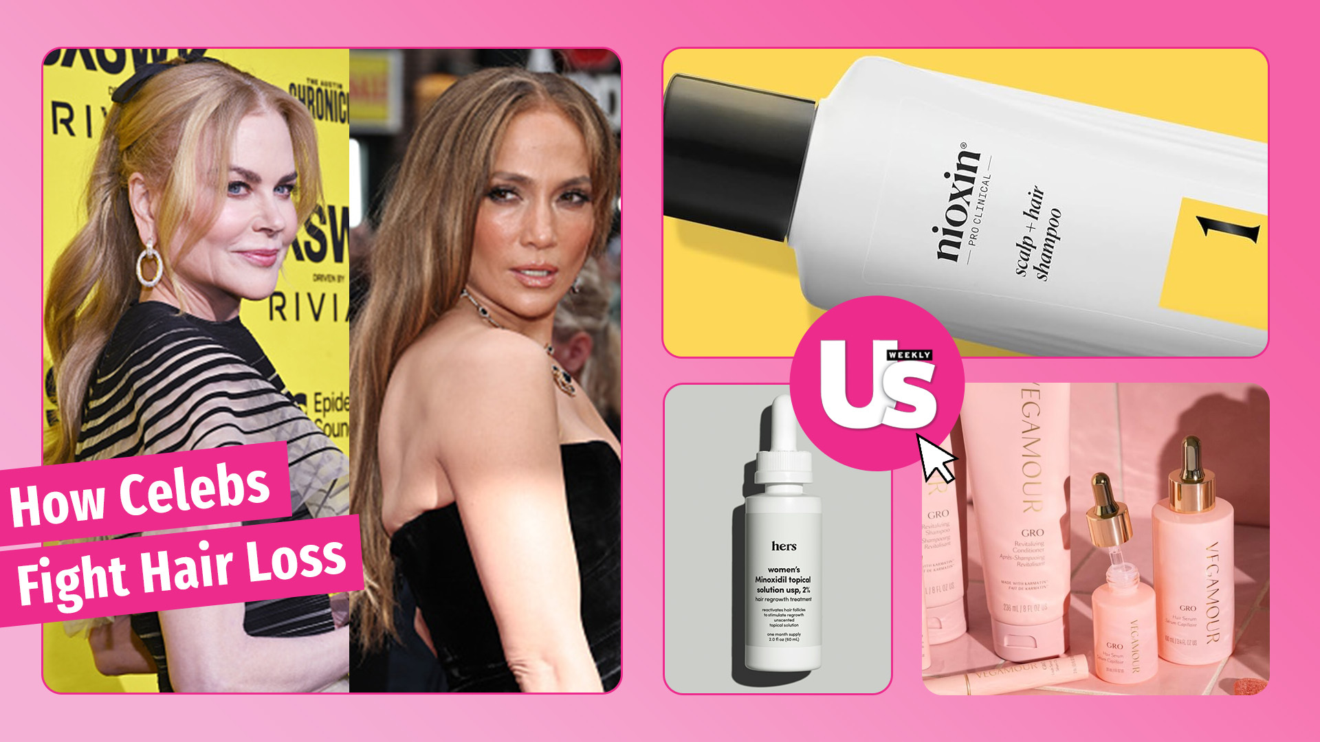 Celebrities' hair loss solutions