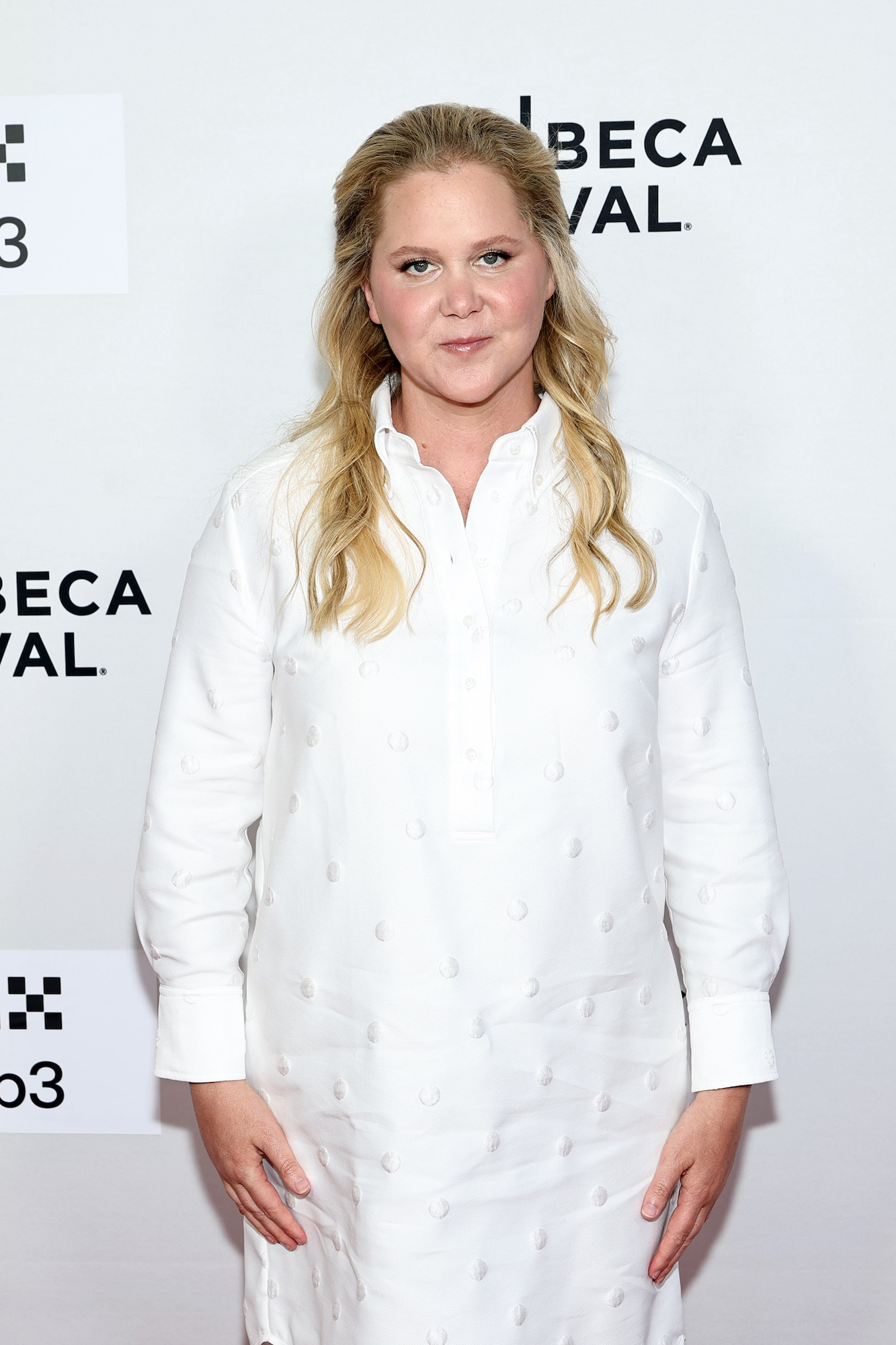 GettyImages-2219708418-Amy-Schumer-Shares-Health-Update-After-Undergoing-Back-Surgery.